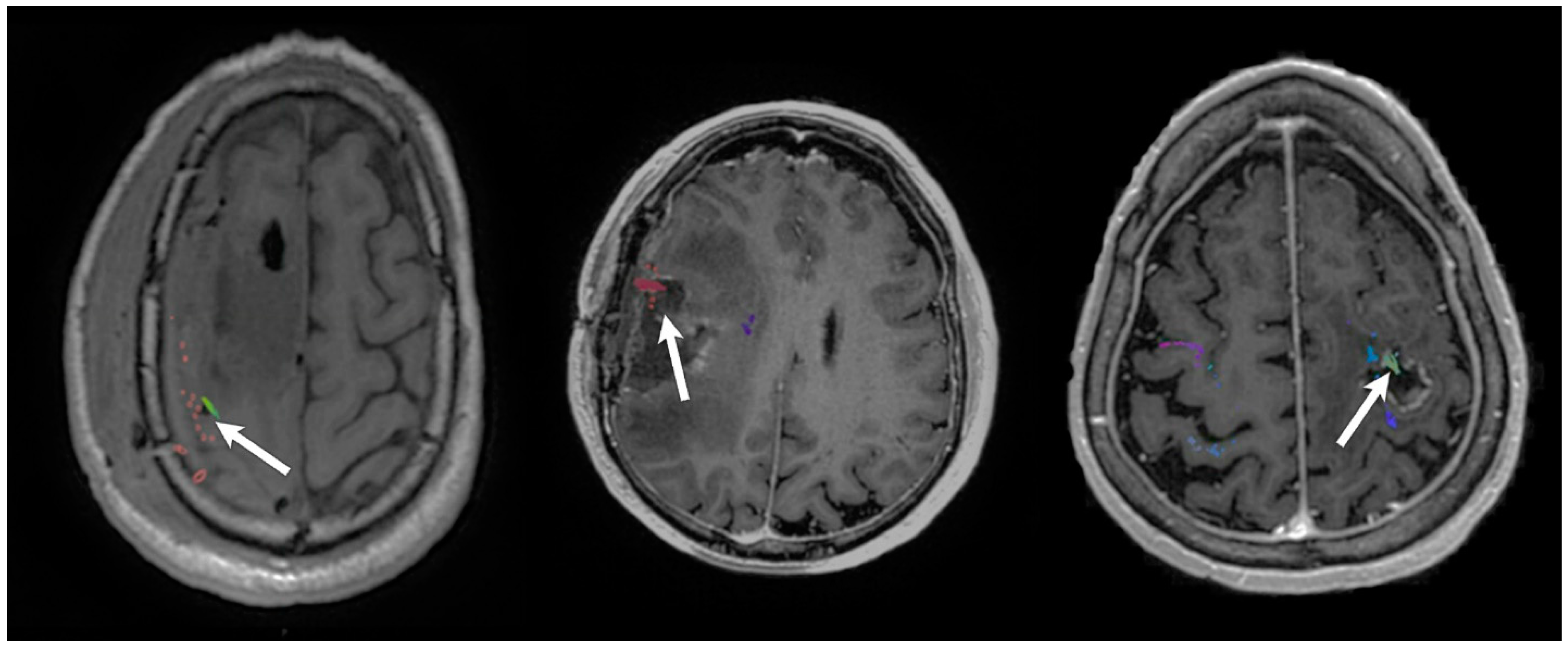 Cancers 14 00340 g004