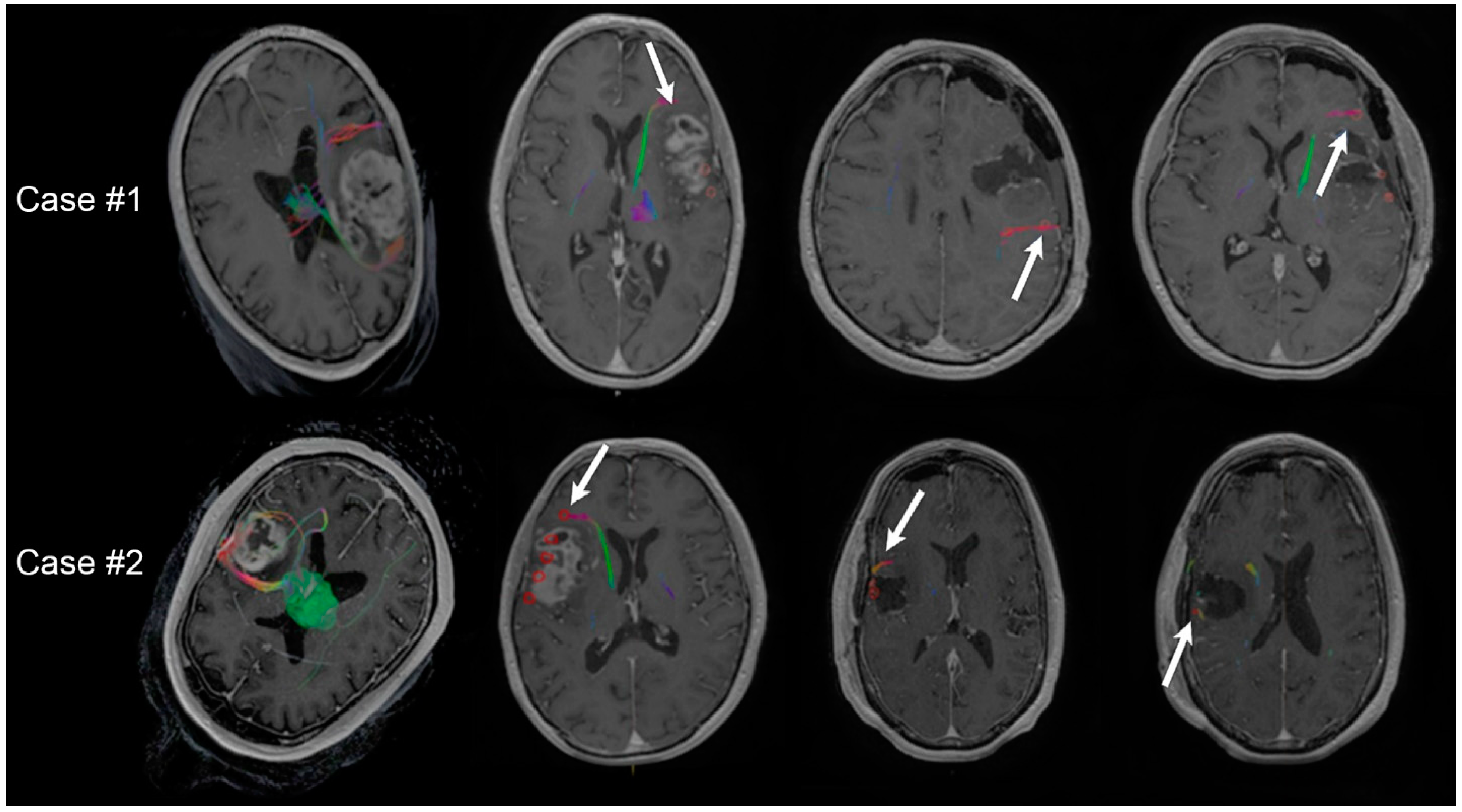 Cancers 14 00340 g005