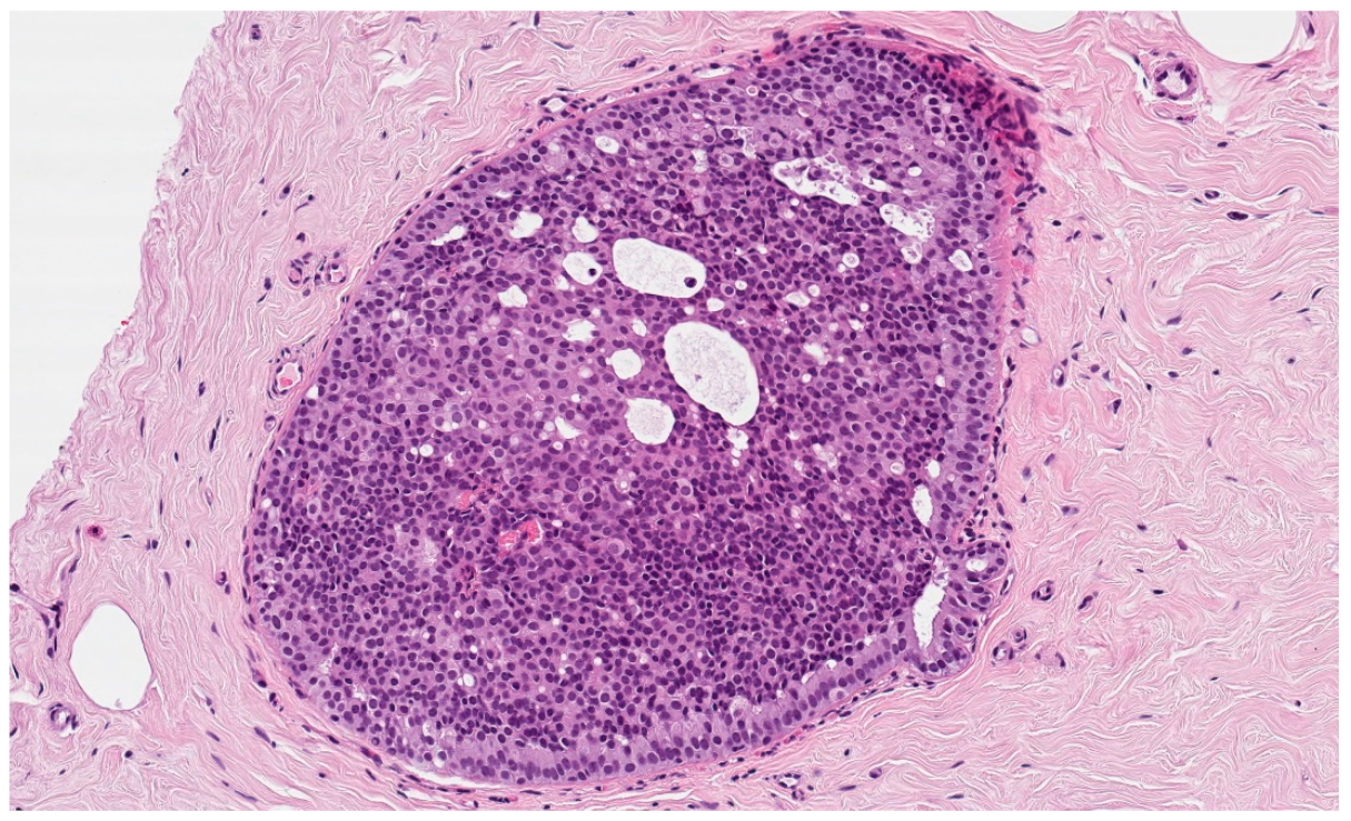 Cancers 14 00370 g002