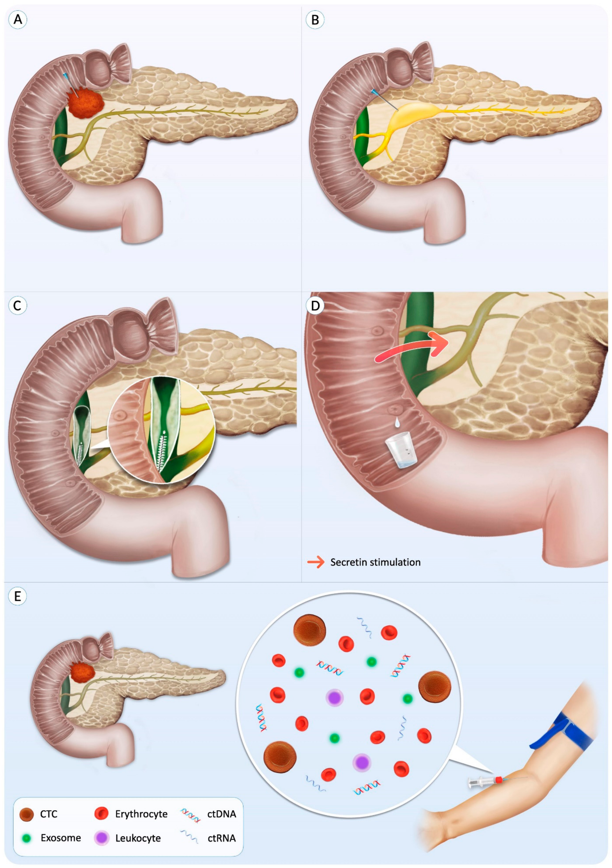 Cancers 14 00397 g001 Cancers 14 00397 g001