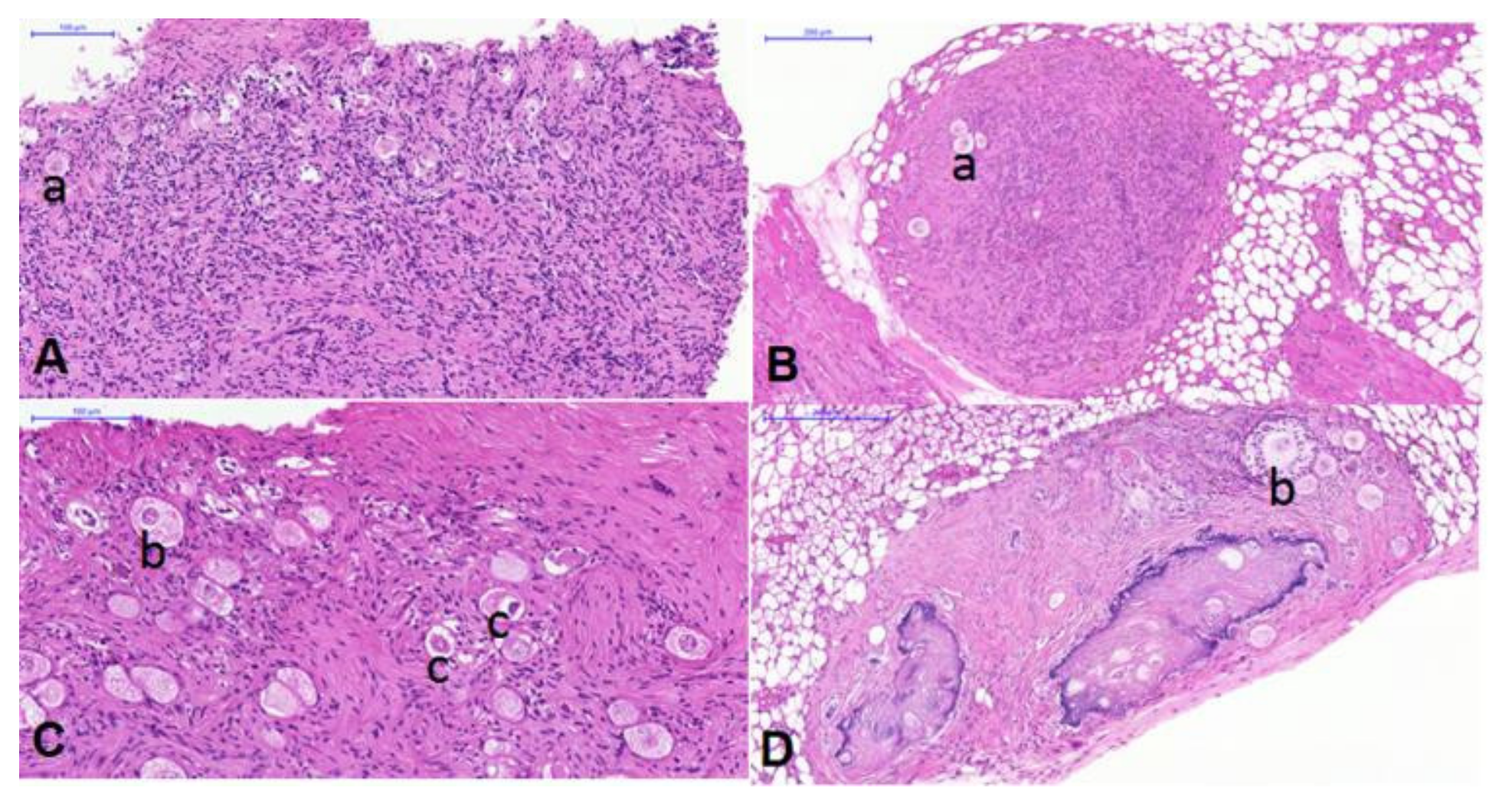 Cancers 14 00399 g001