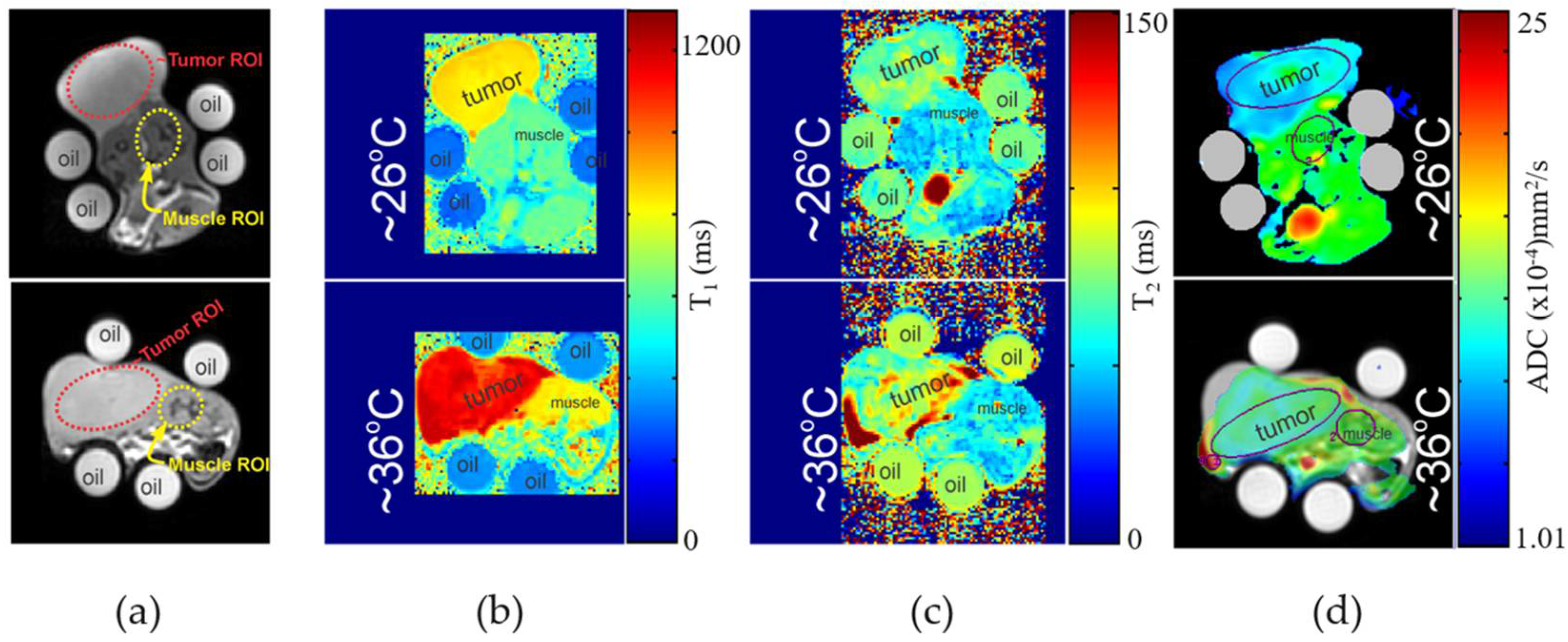 Cancers 14 00405 g004