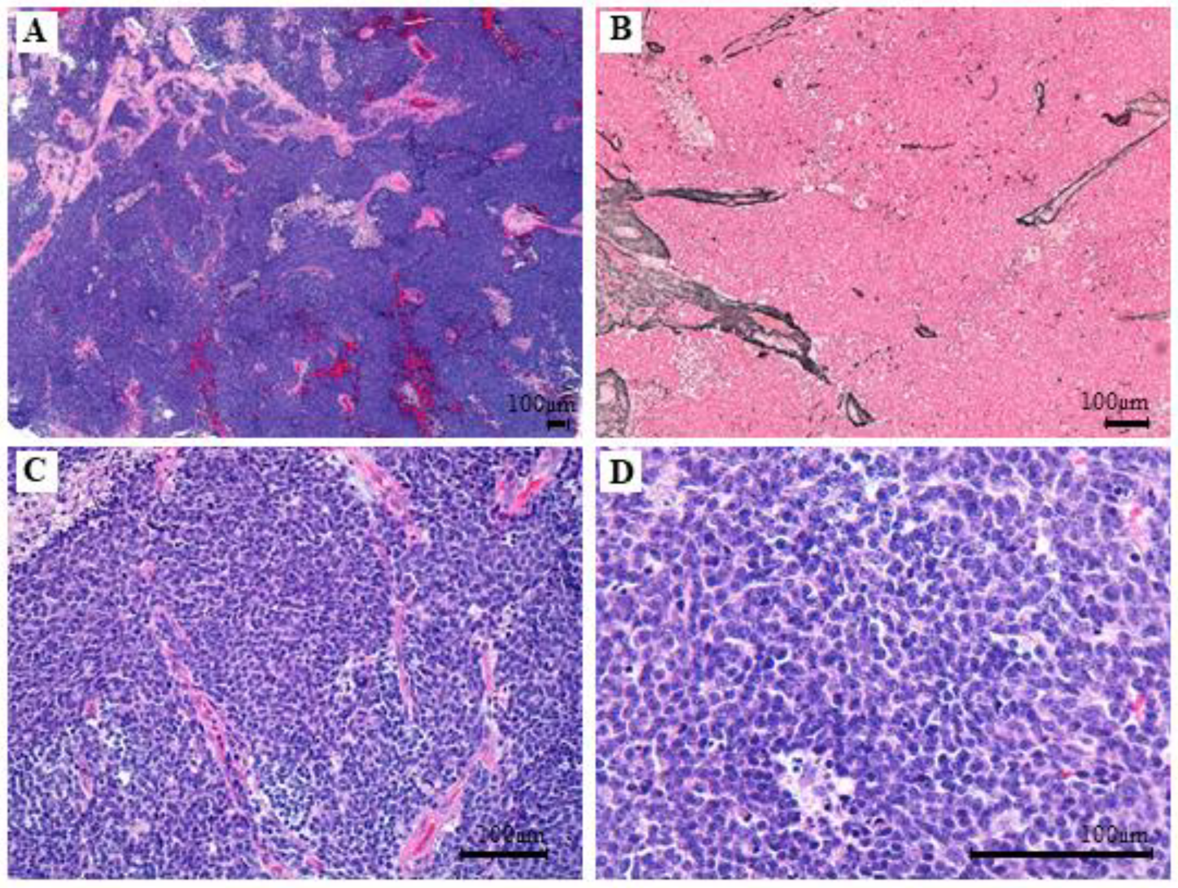 Cancers 14 00421 g004