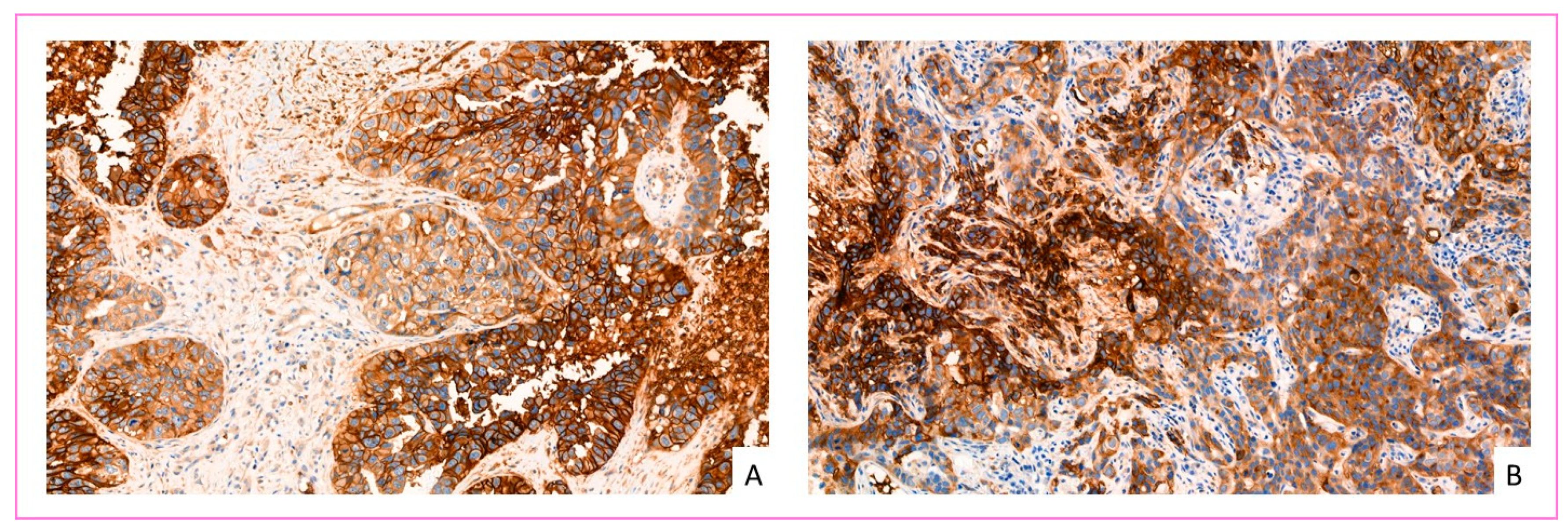 Cancers 14 00437 g003