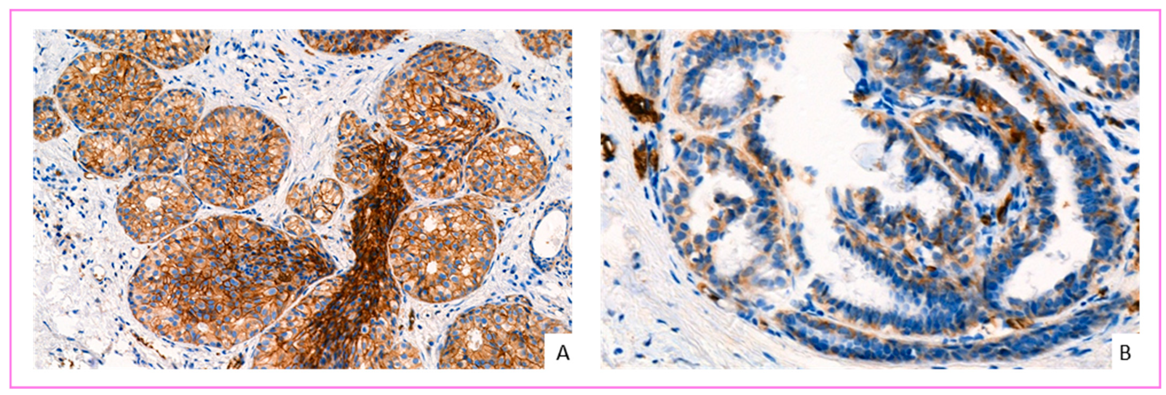 Cancers 14 00437 g004