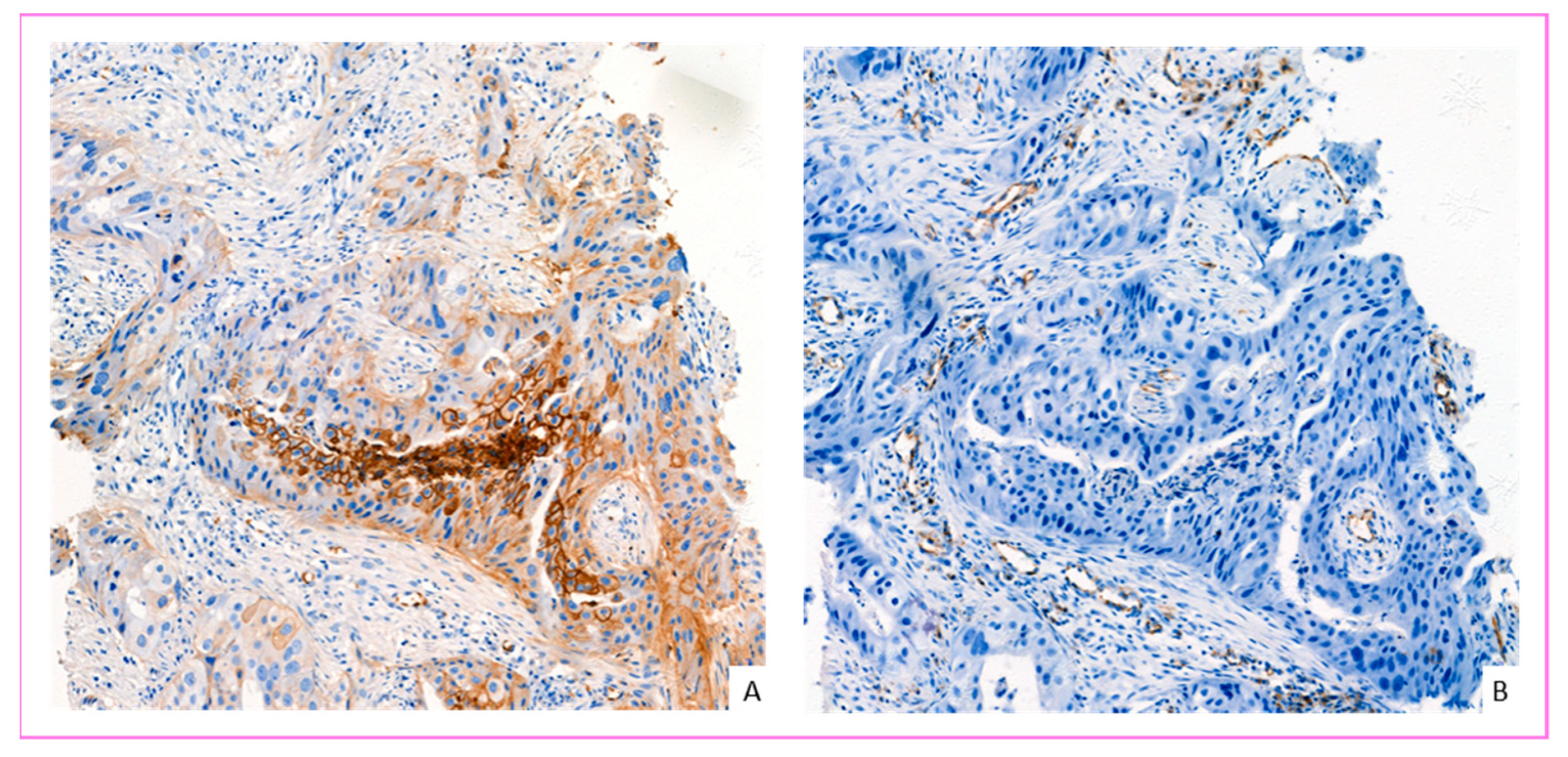 Cancers 14 00437 g005