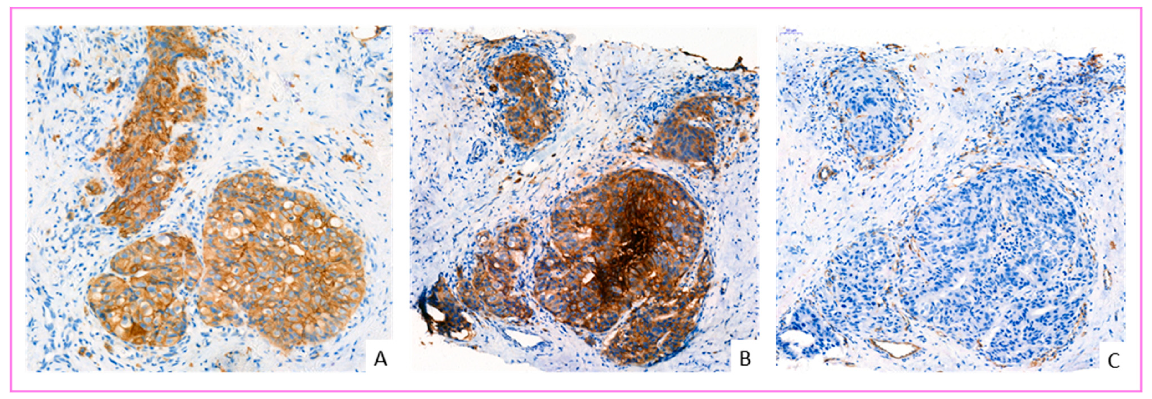 Cancers 14 00437 g006