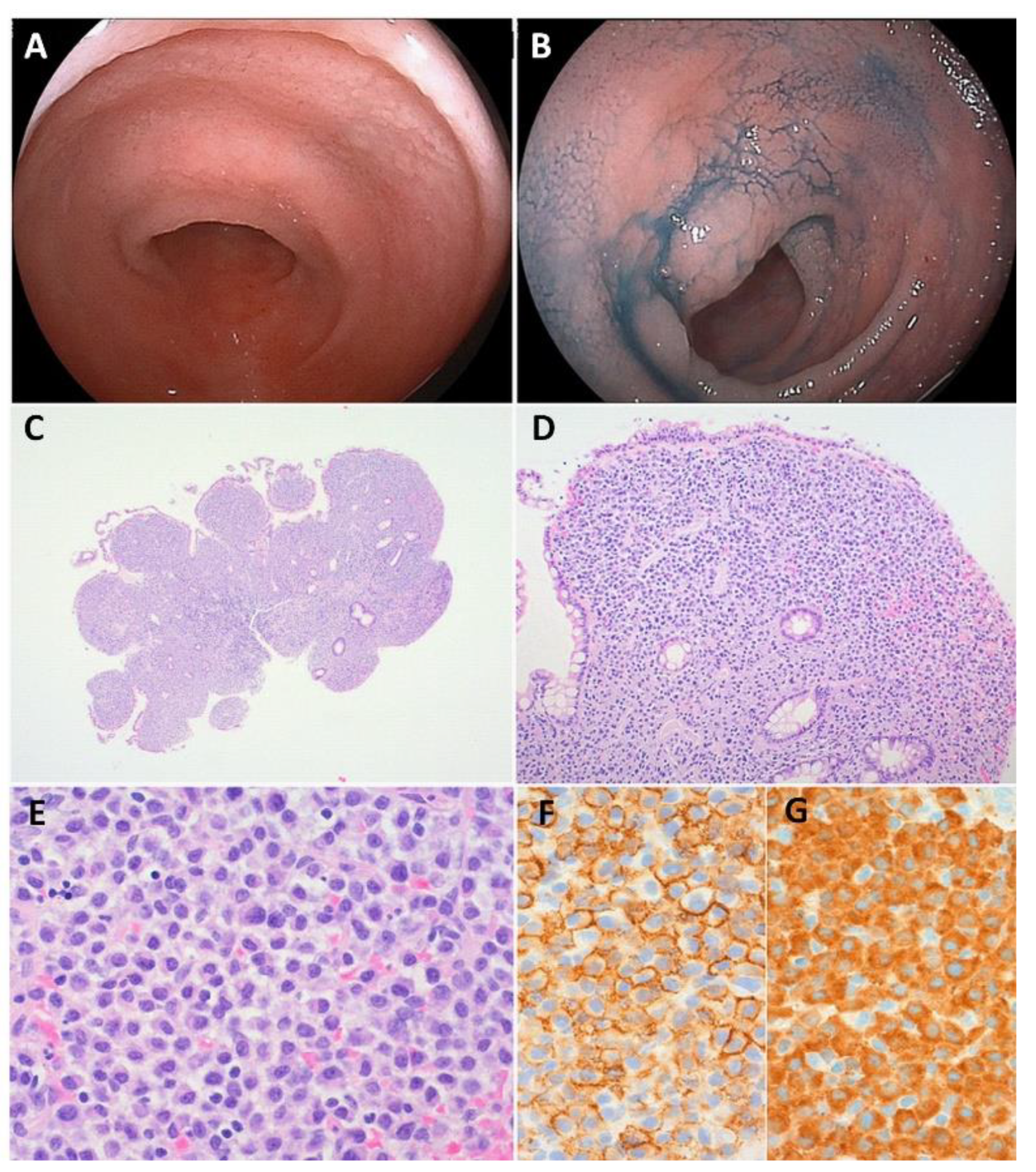 Cancers 14 00446 g002