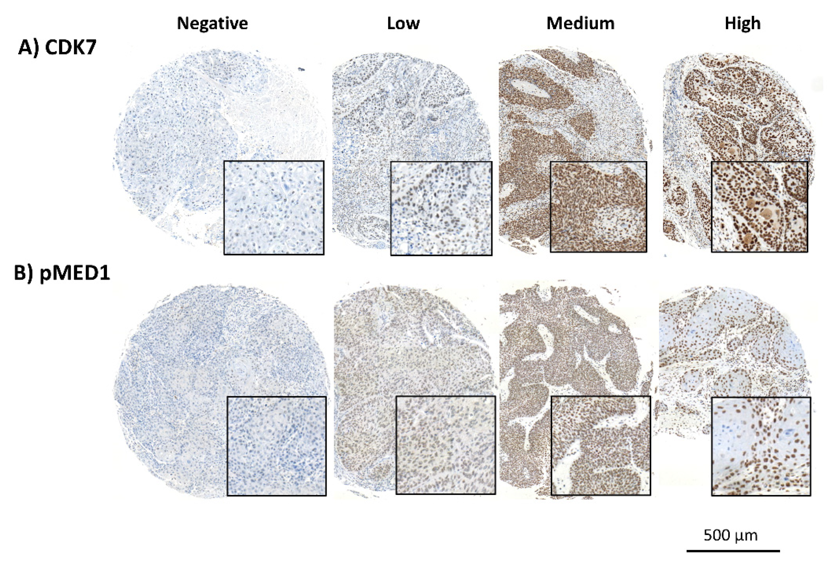 Cancers 14 00492 g001