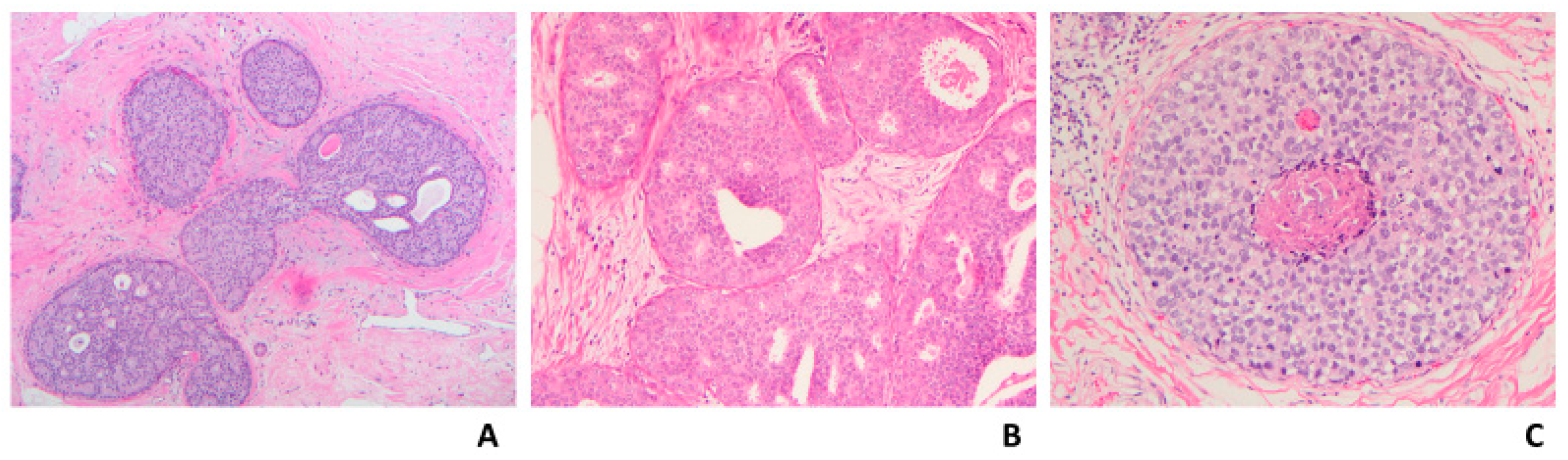 Cancers 14 00507 g005