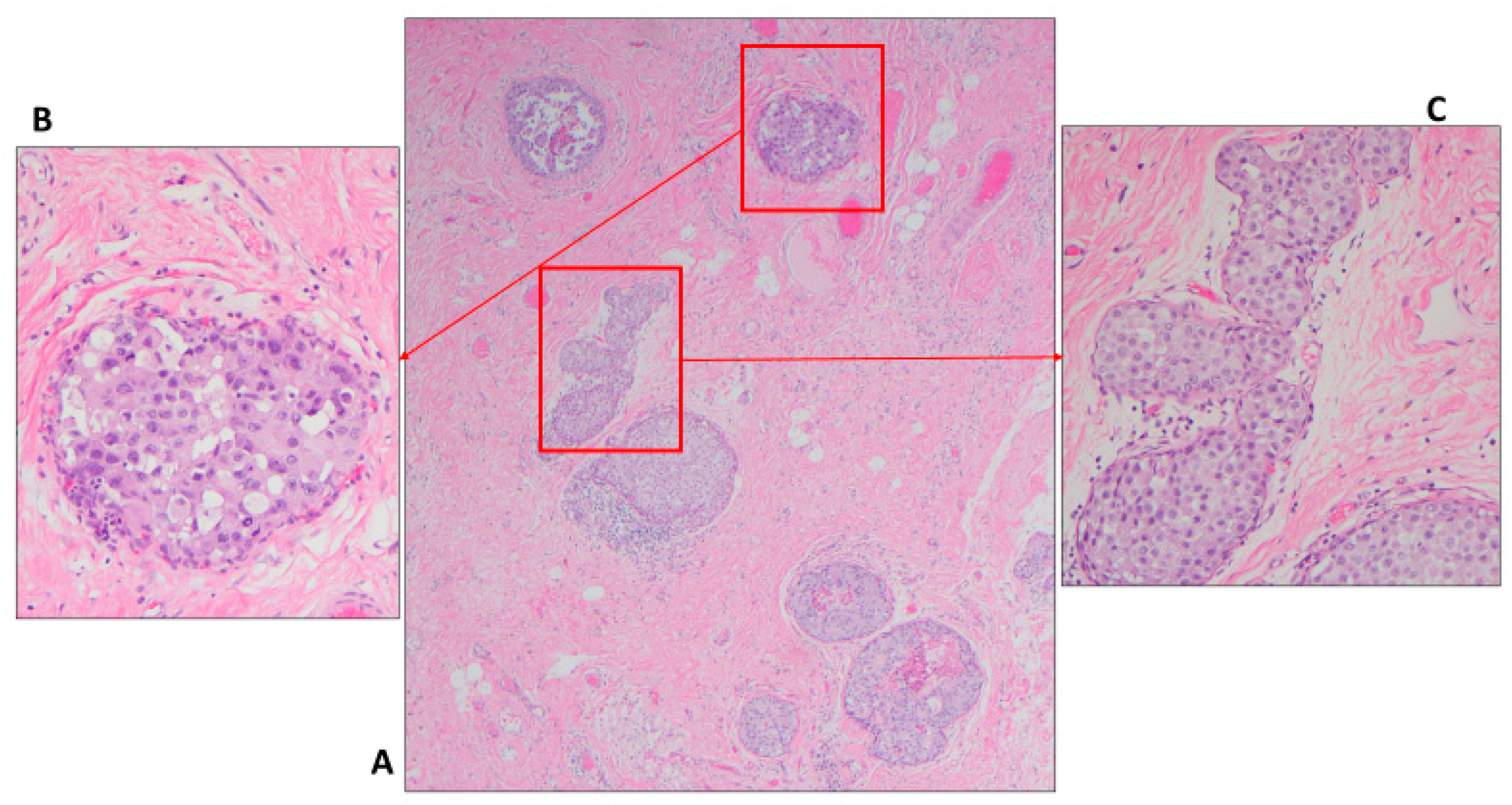 Cancers 14 00507 g006