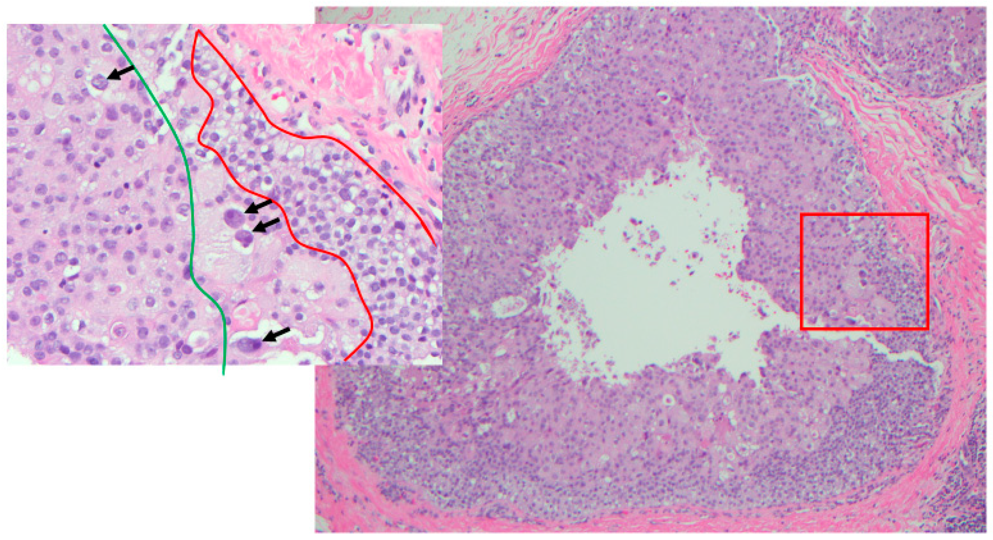 Cancers 14 00507 g007