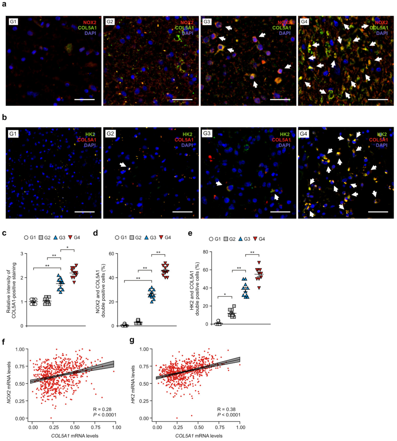 Cancers 14 00516 g006