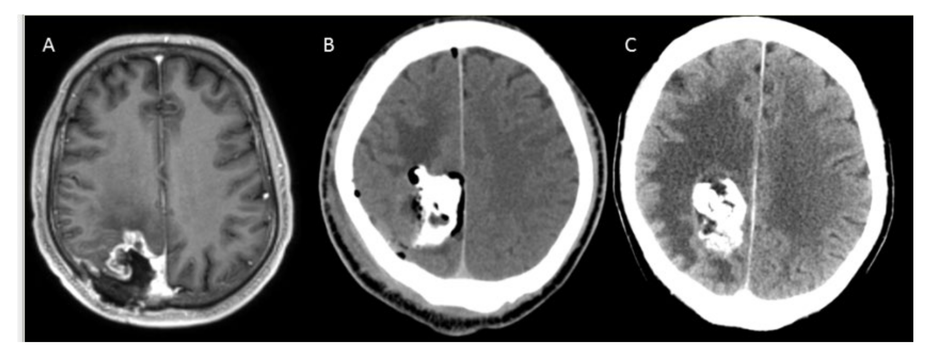 Cancers 14 00541 g002