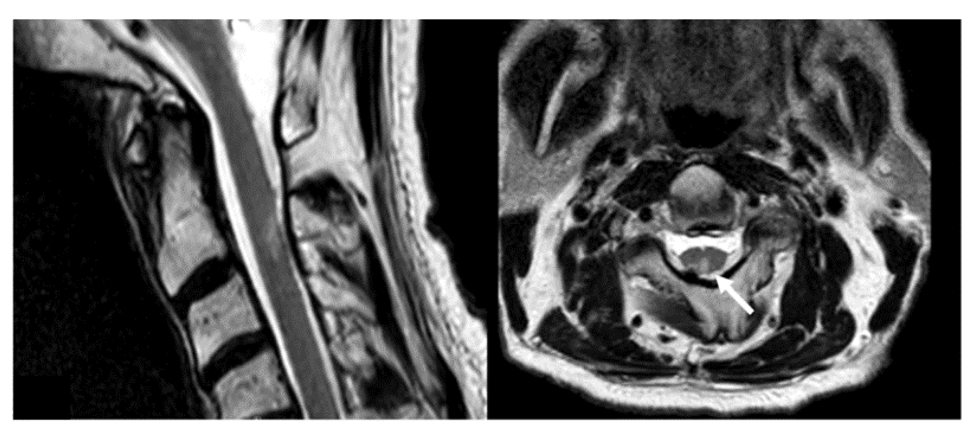 Cancers 14 00541 g004