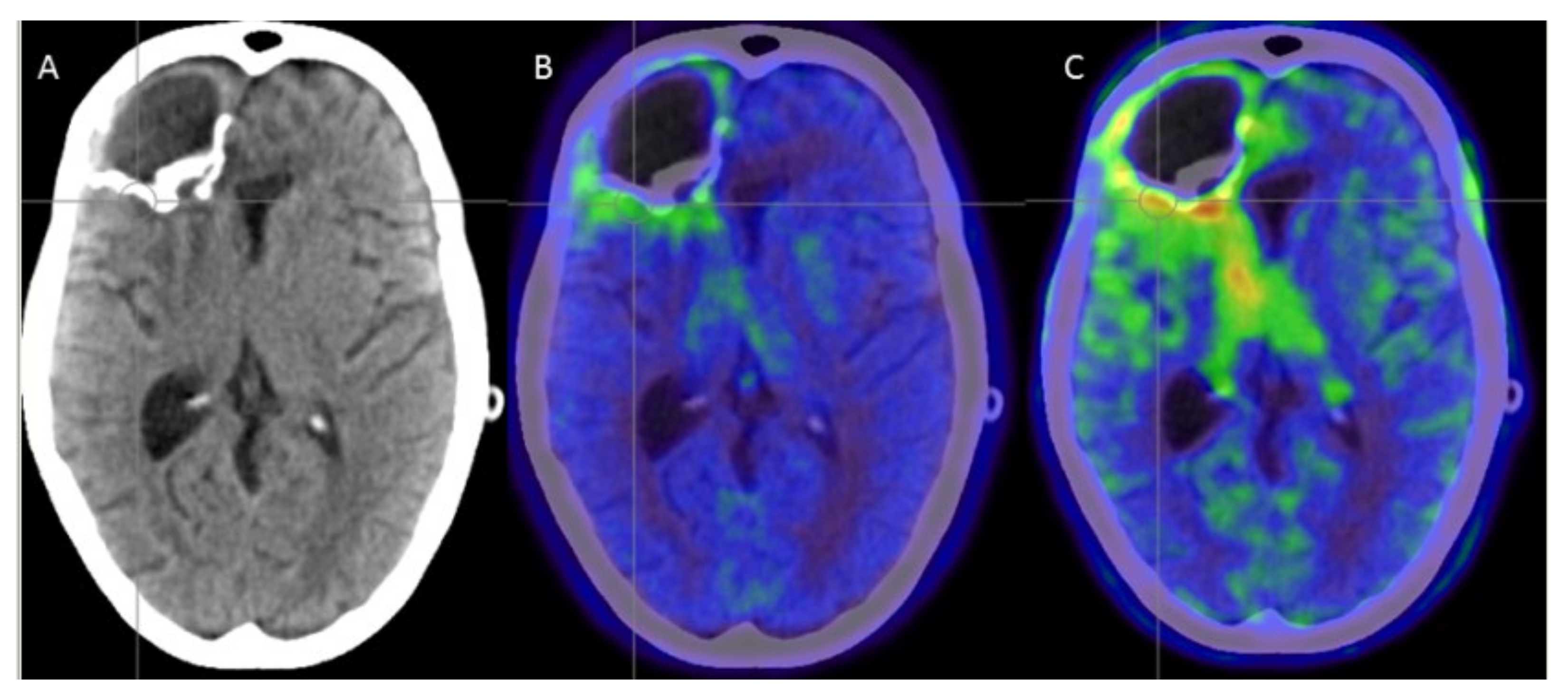 Cancers 14 00541 g005