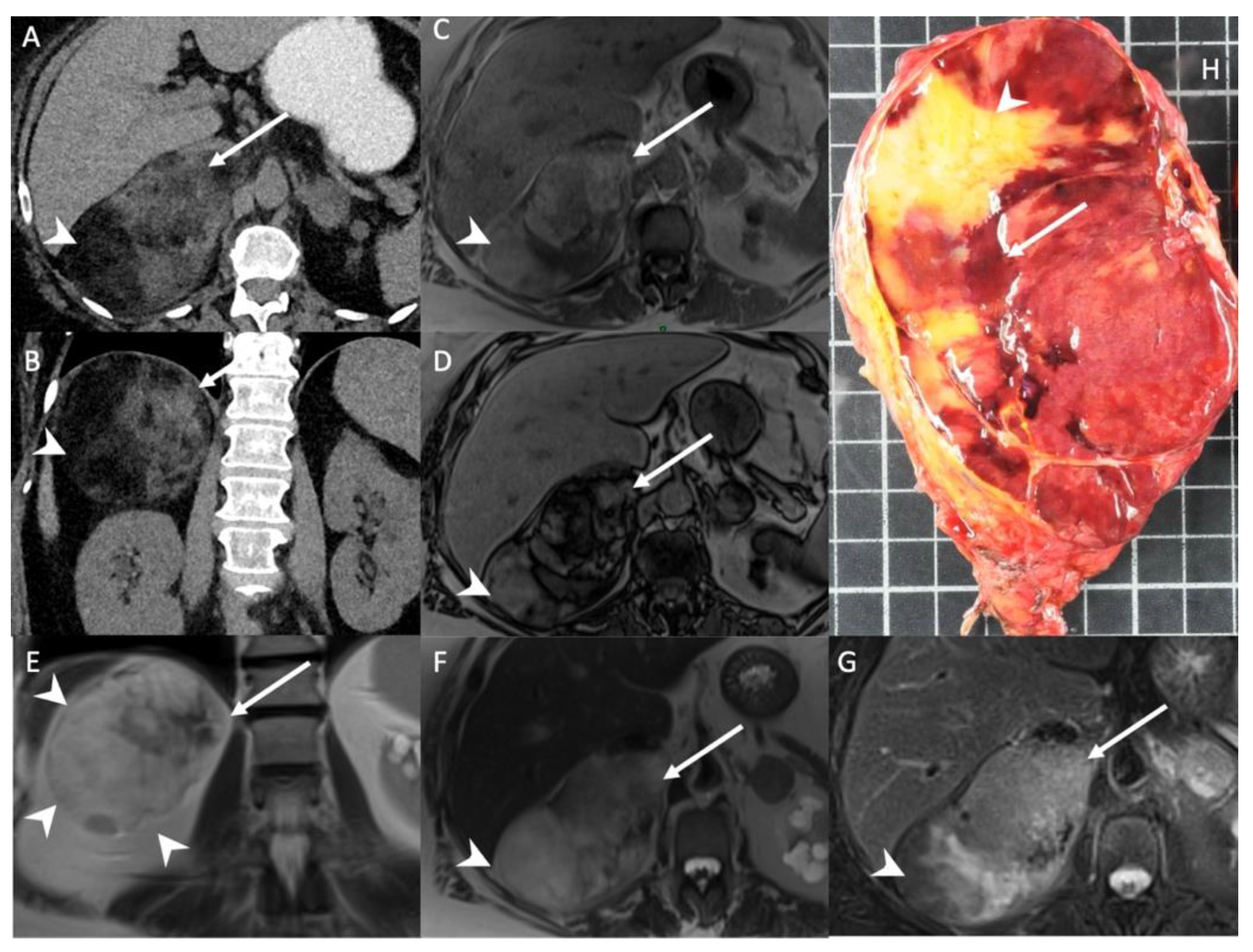 Cancers 14 00569 g001