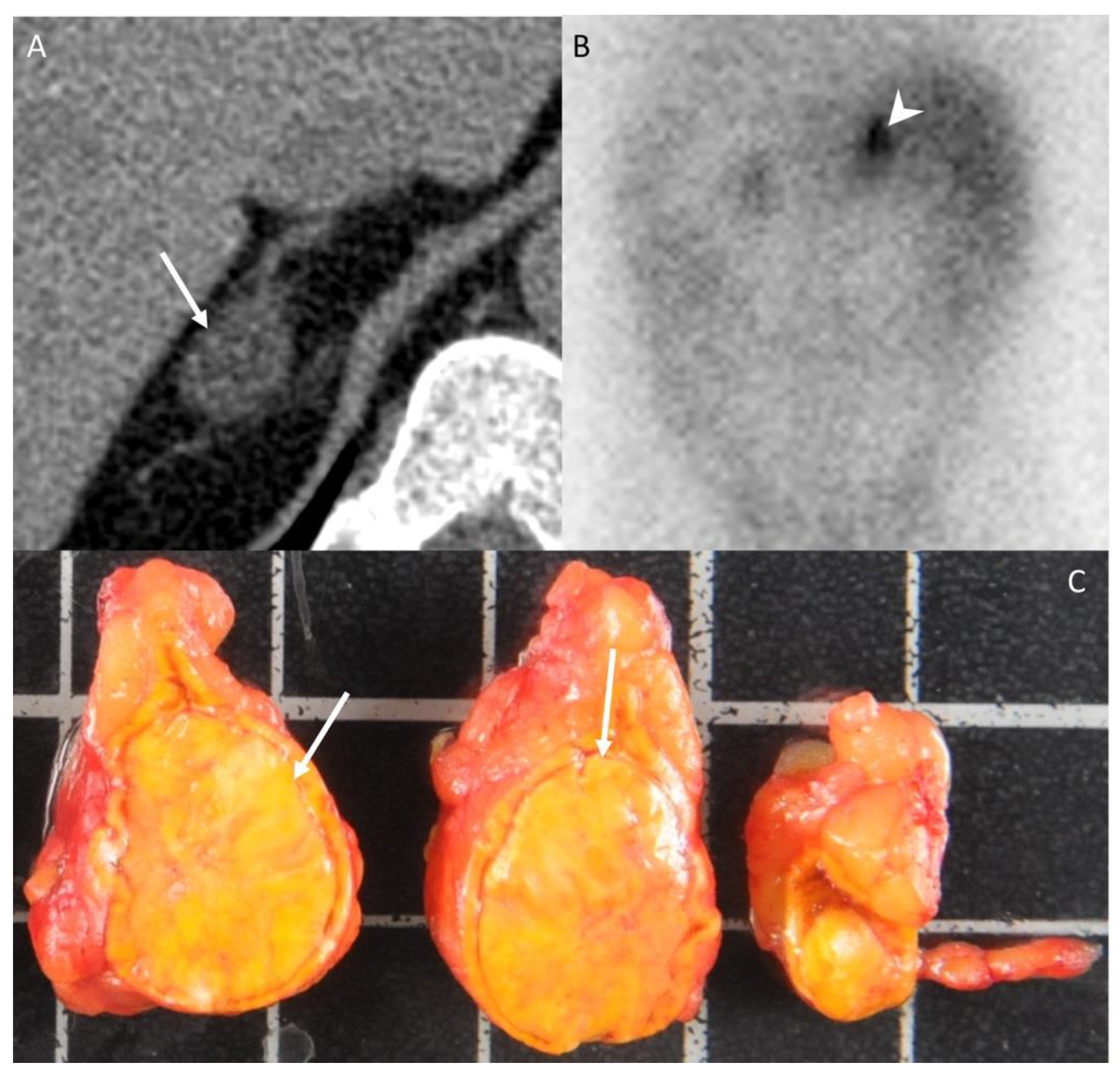 Cancers 14 00569 g002