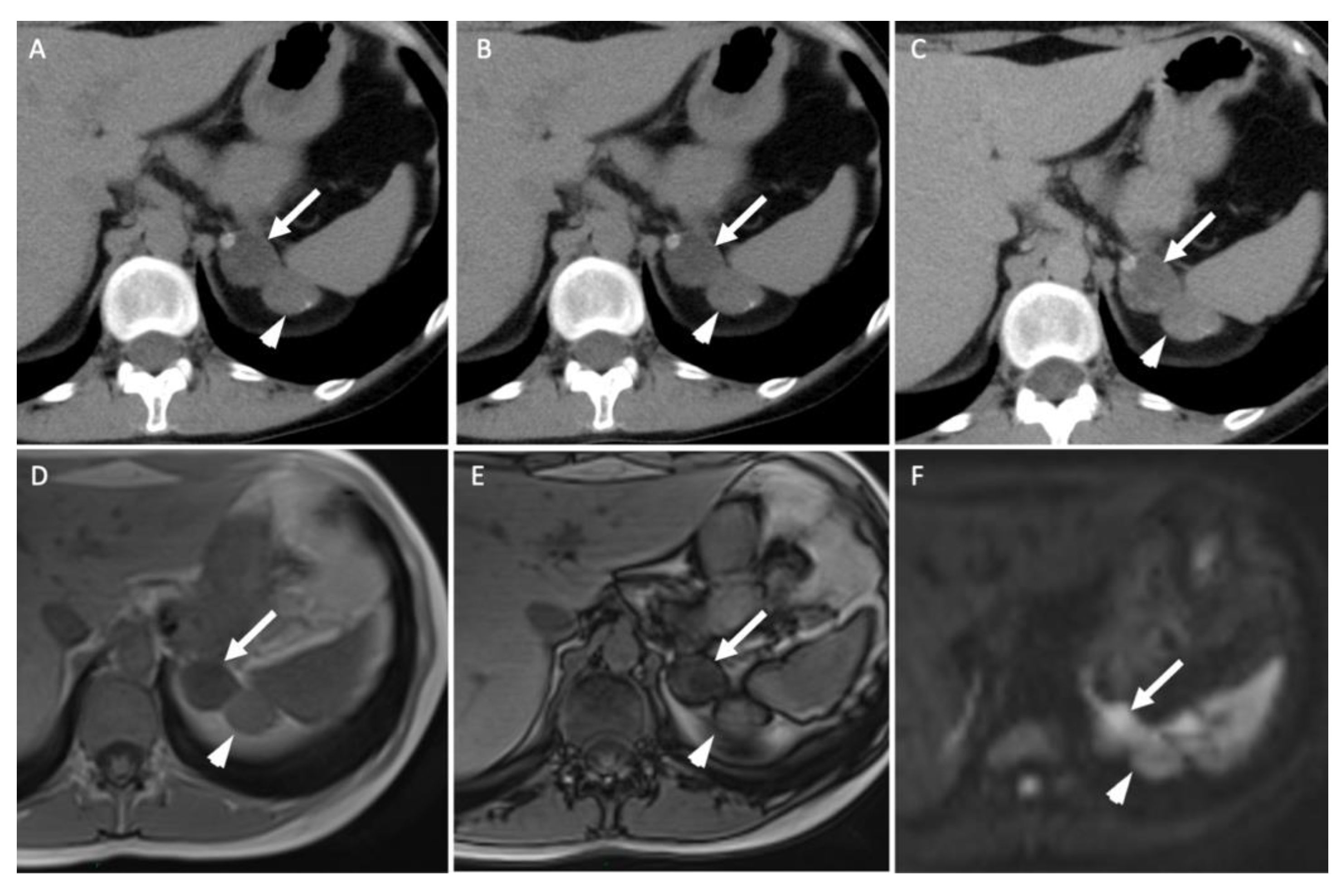 Cancers 14 00569 g003