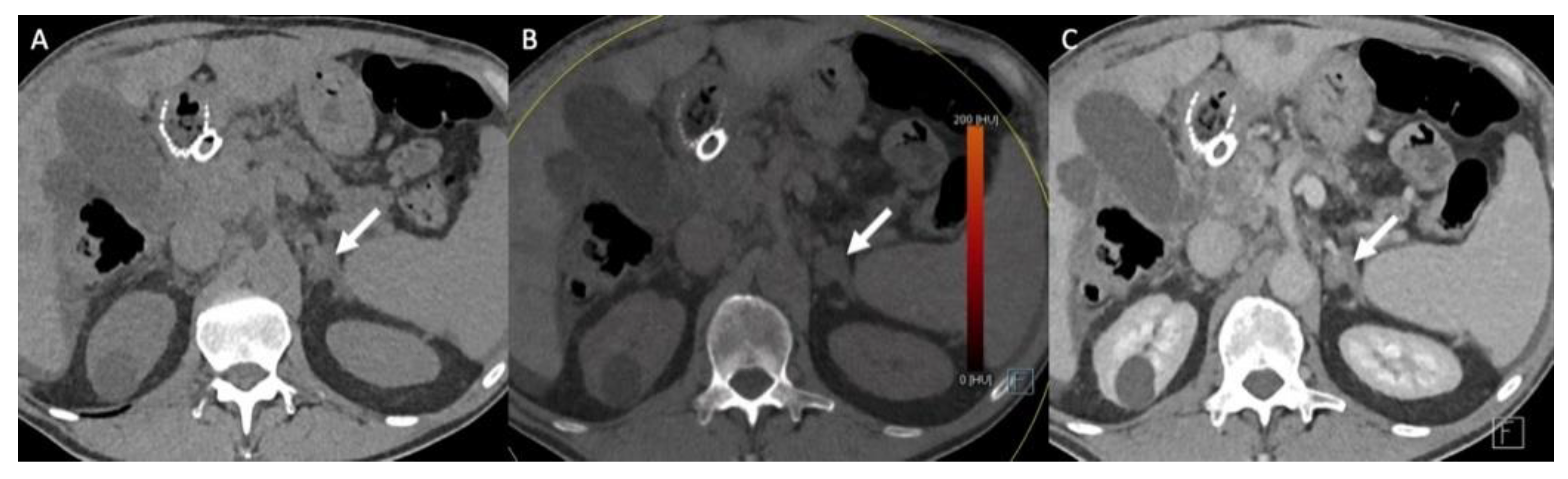 Cancers 14 00569 g005