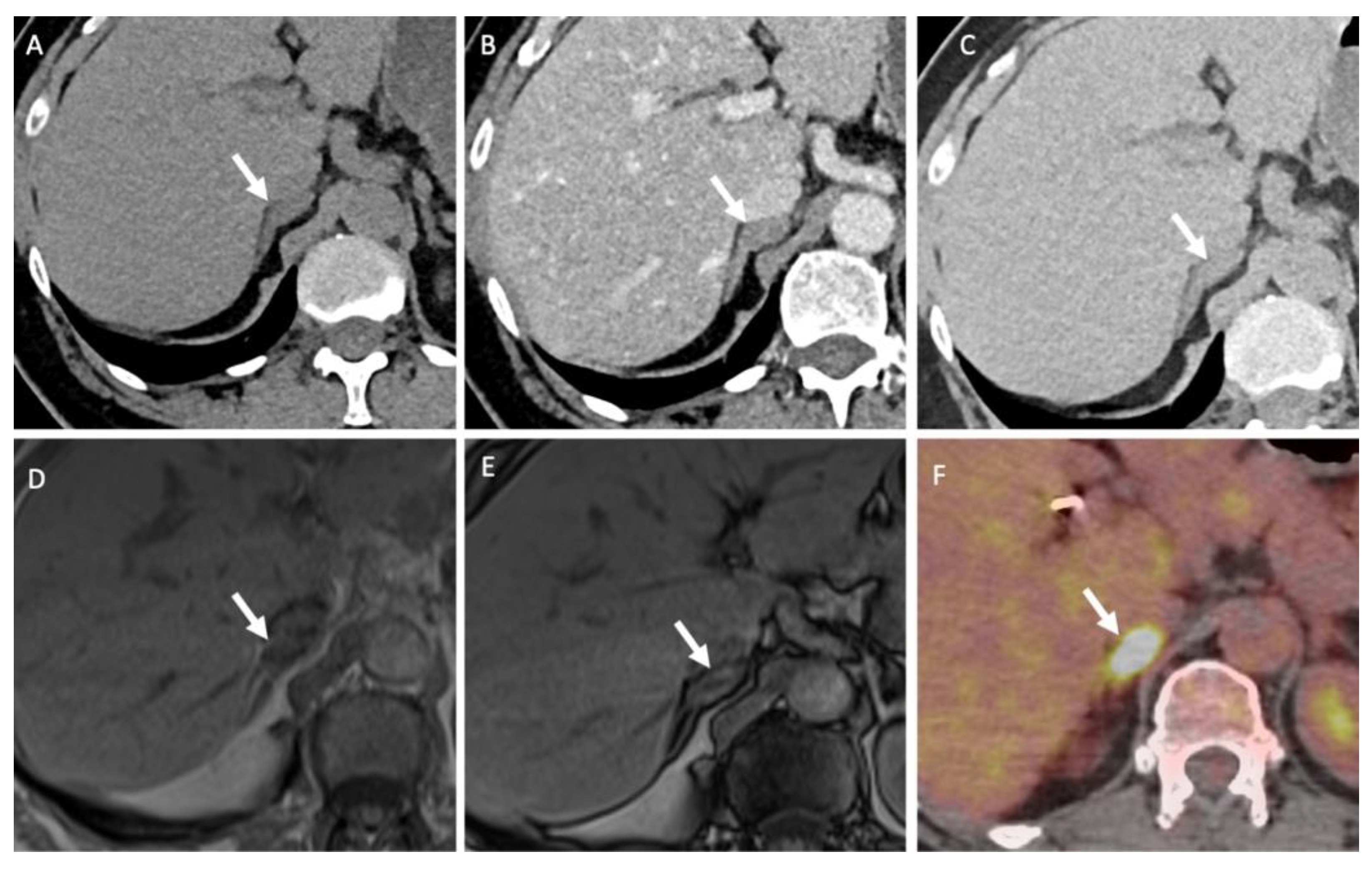 Cancers 14 00569 g006