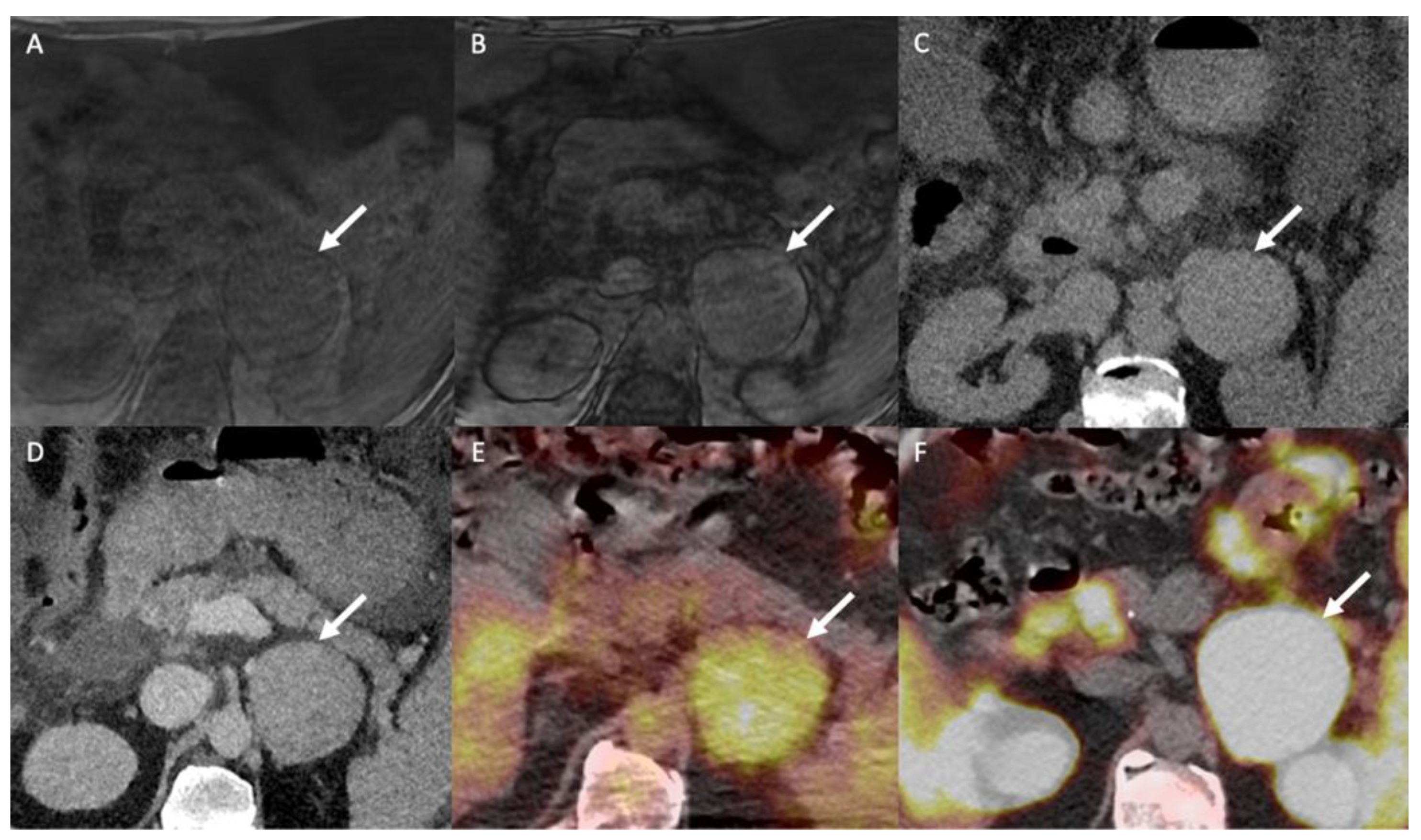 Cancers 14 00569 g007