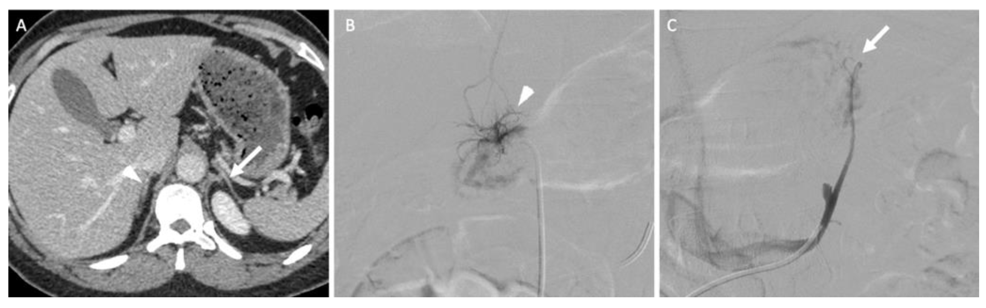 Cancers 14 00569 g009