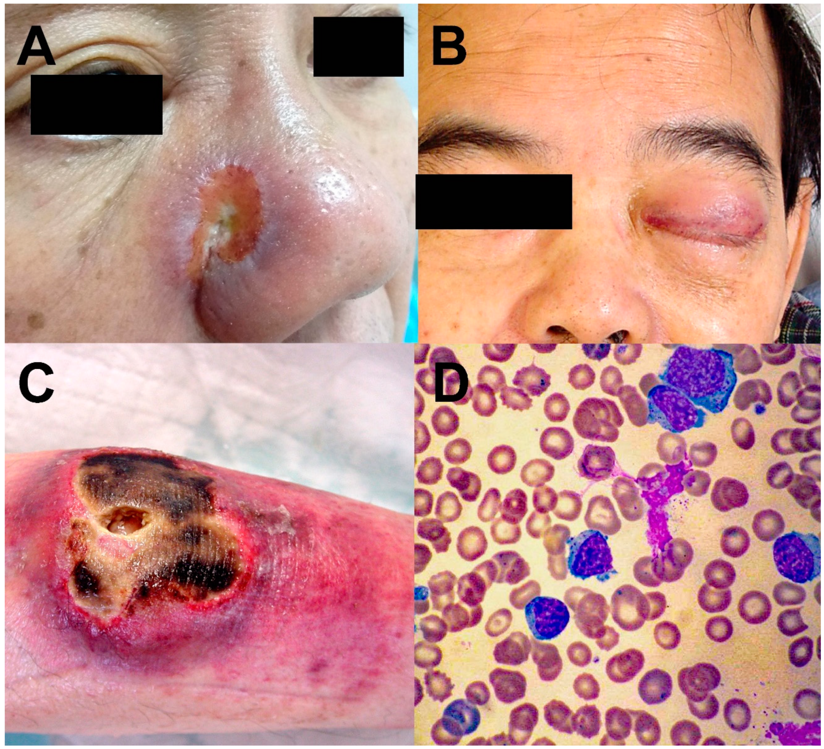 Cancers 14 00597 g001