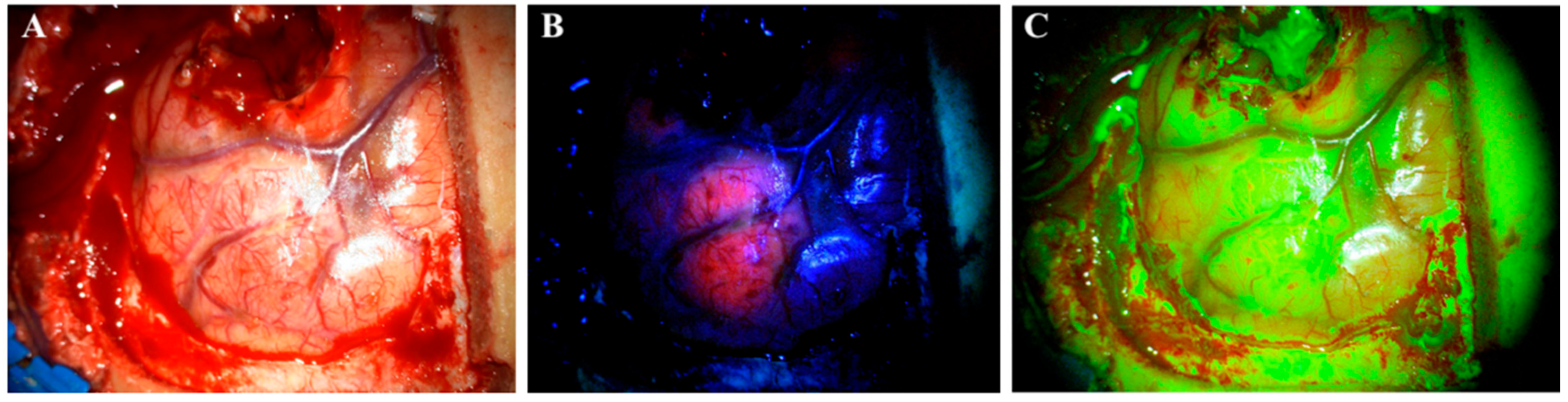 Cancers 14 00617 g001