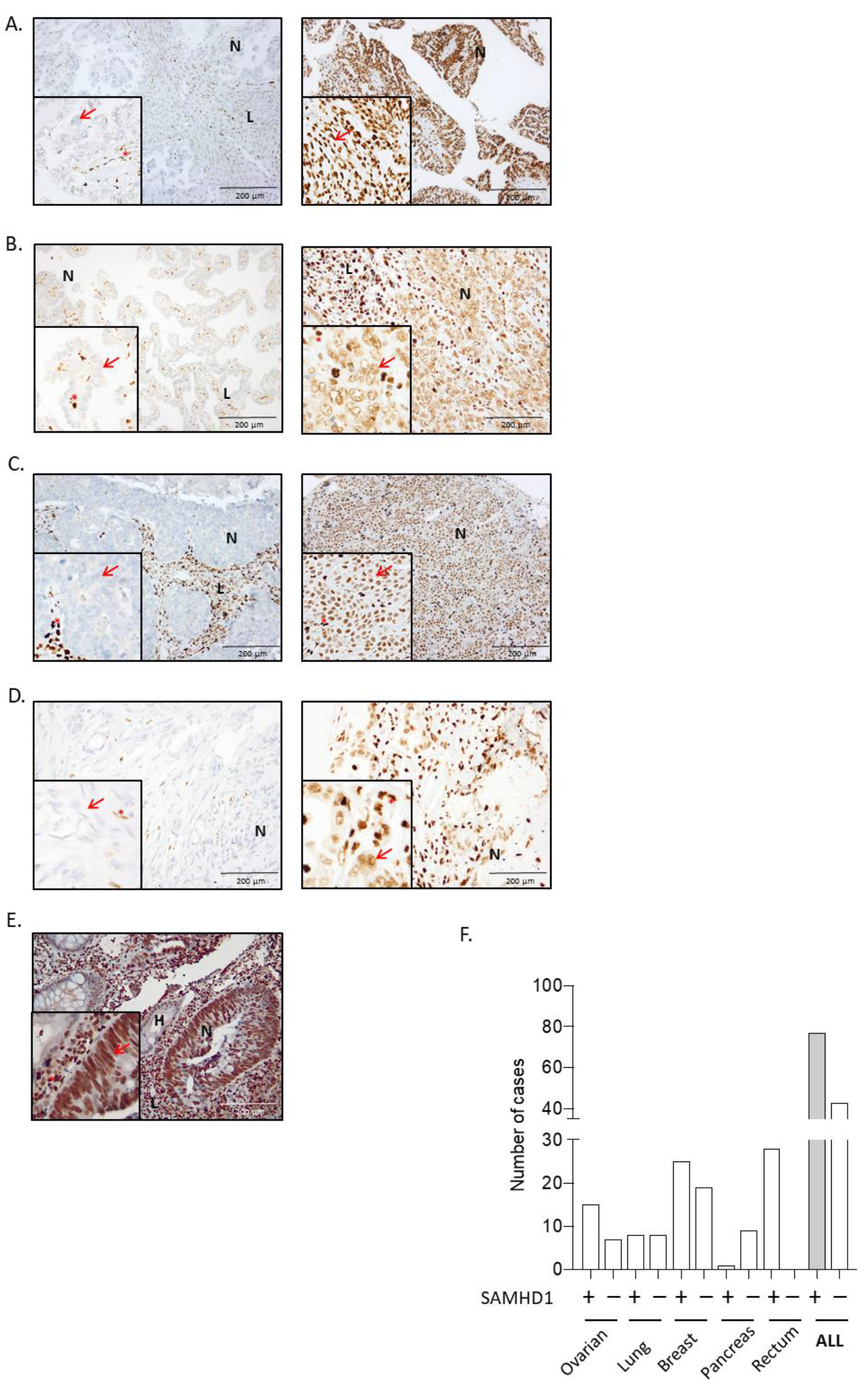 Cancers 14 00641 g001 Cancers 14 00641 g001