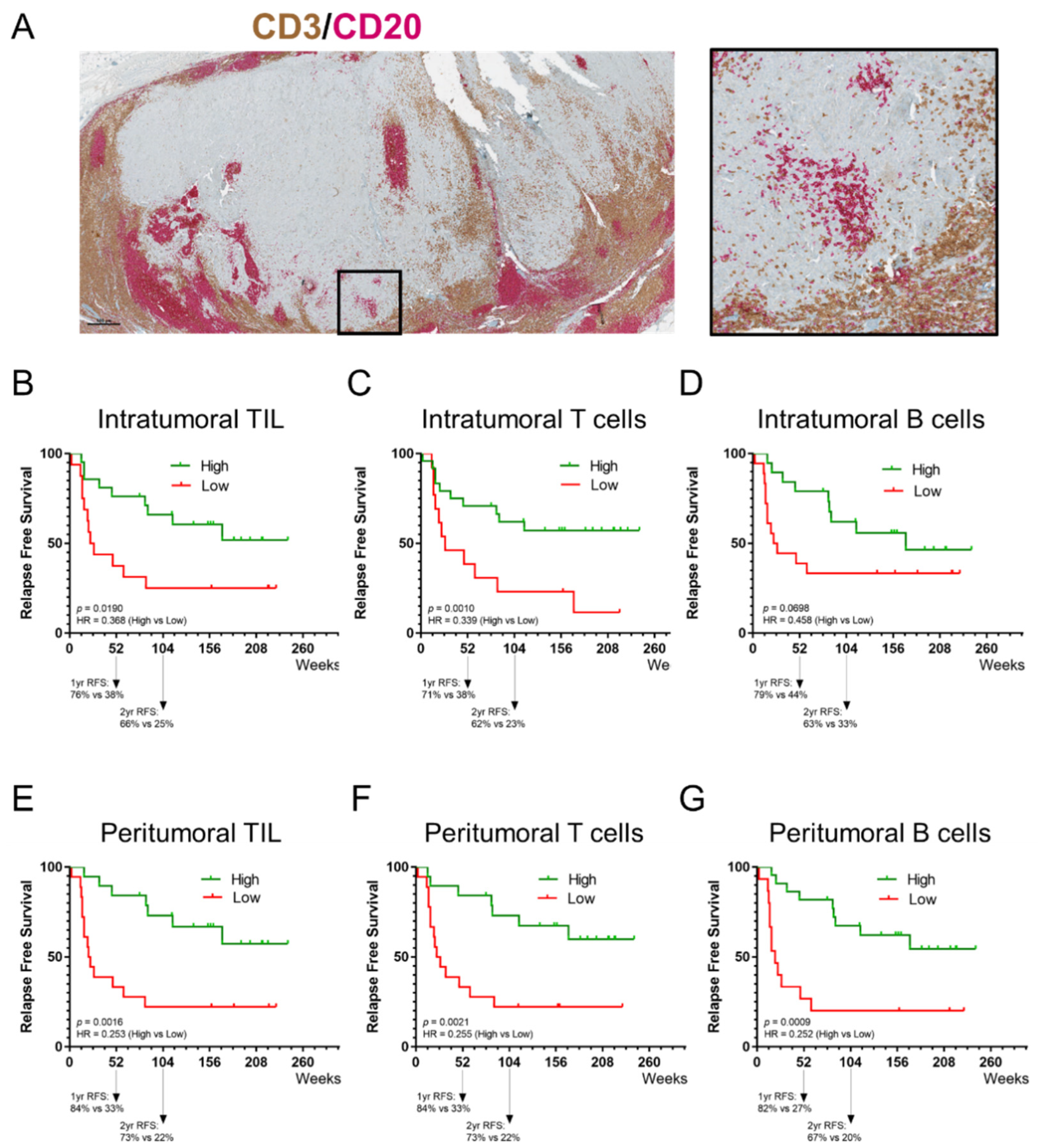 Cancers 14 00682 g003