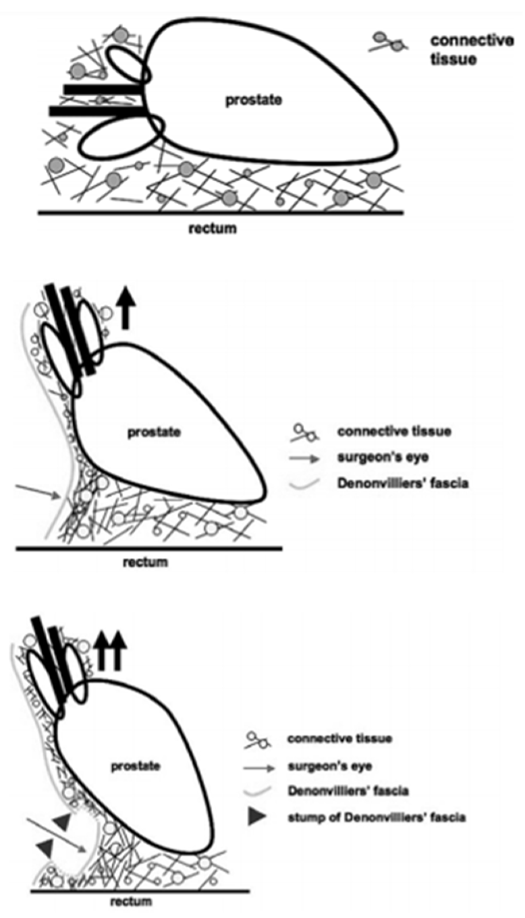 Cancers 14 00688 g003