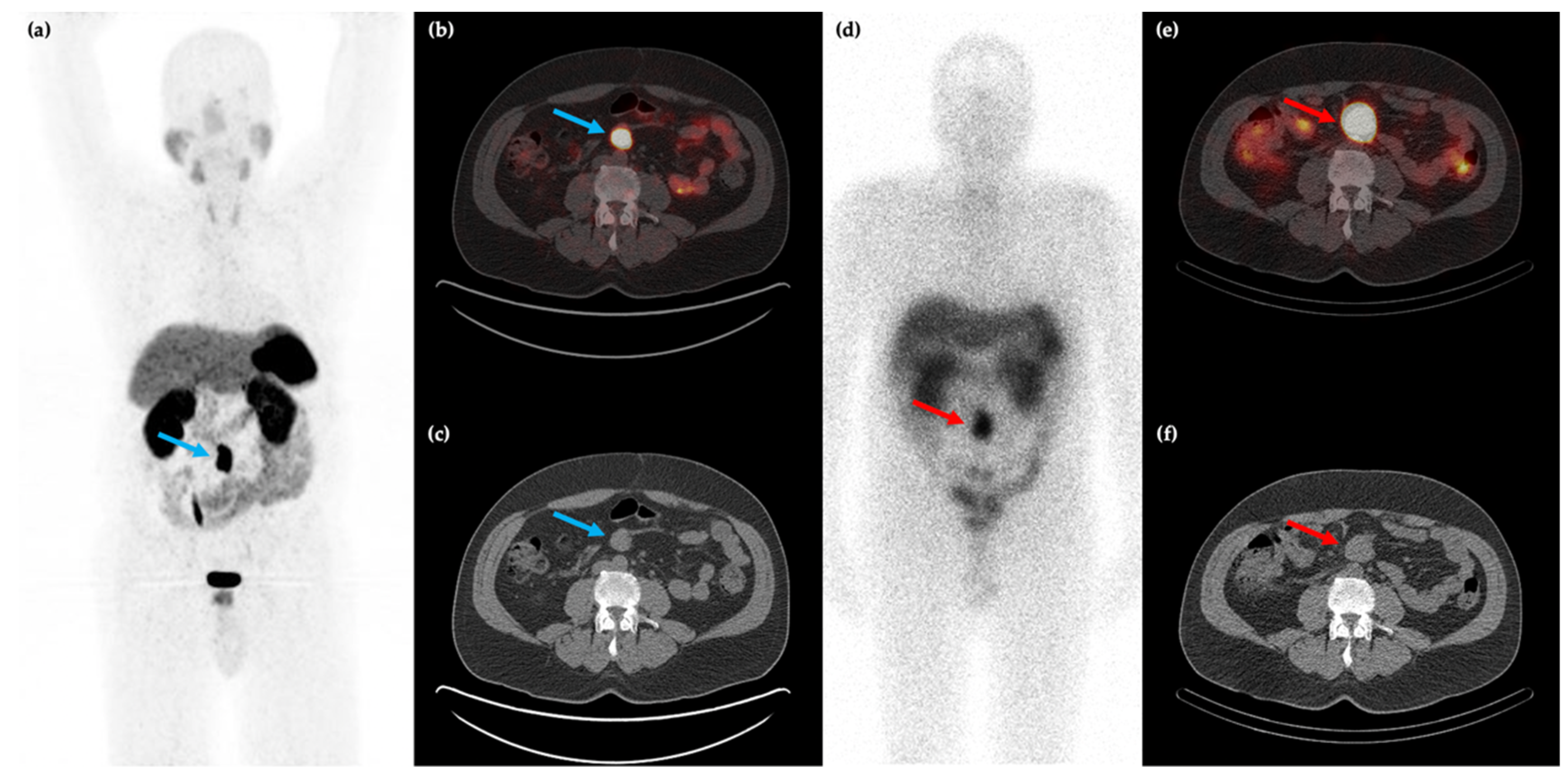 Cancers 14 00761 g001