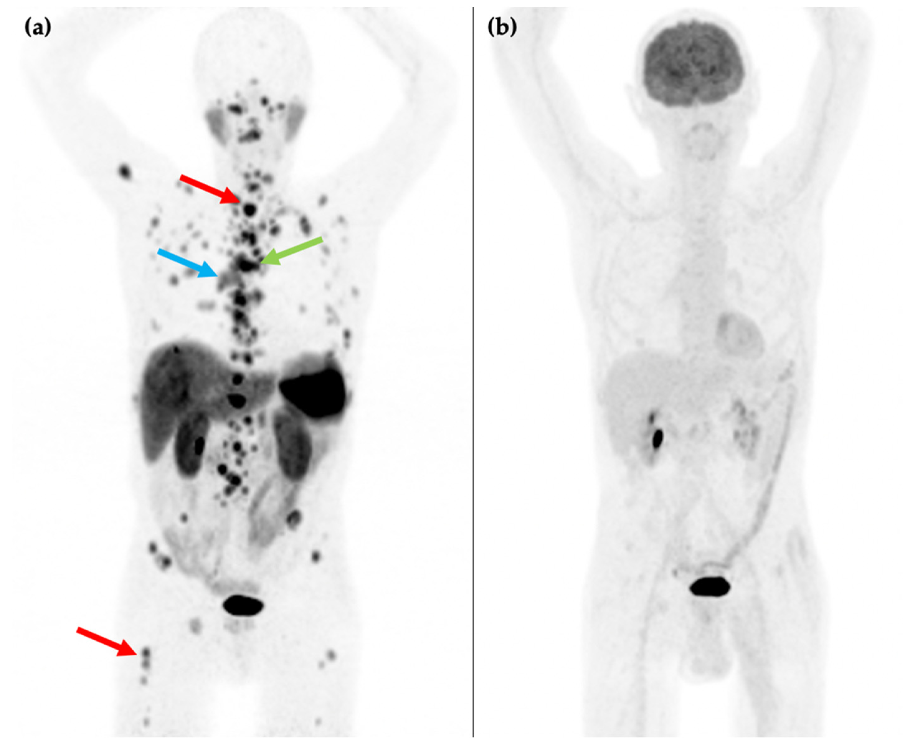 Cancers 14 00761 g002