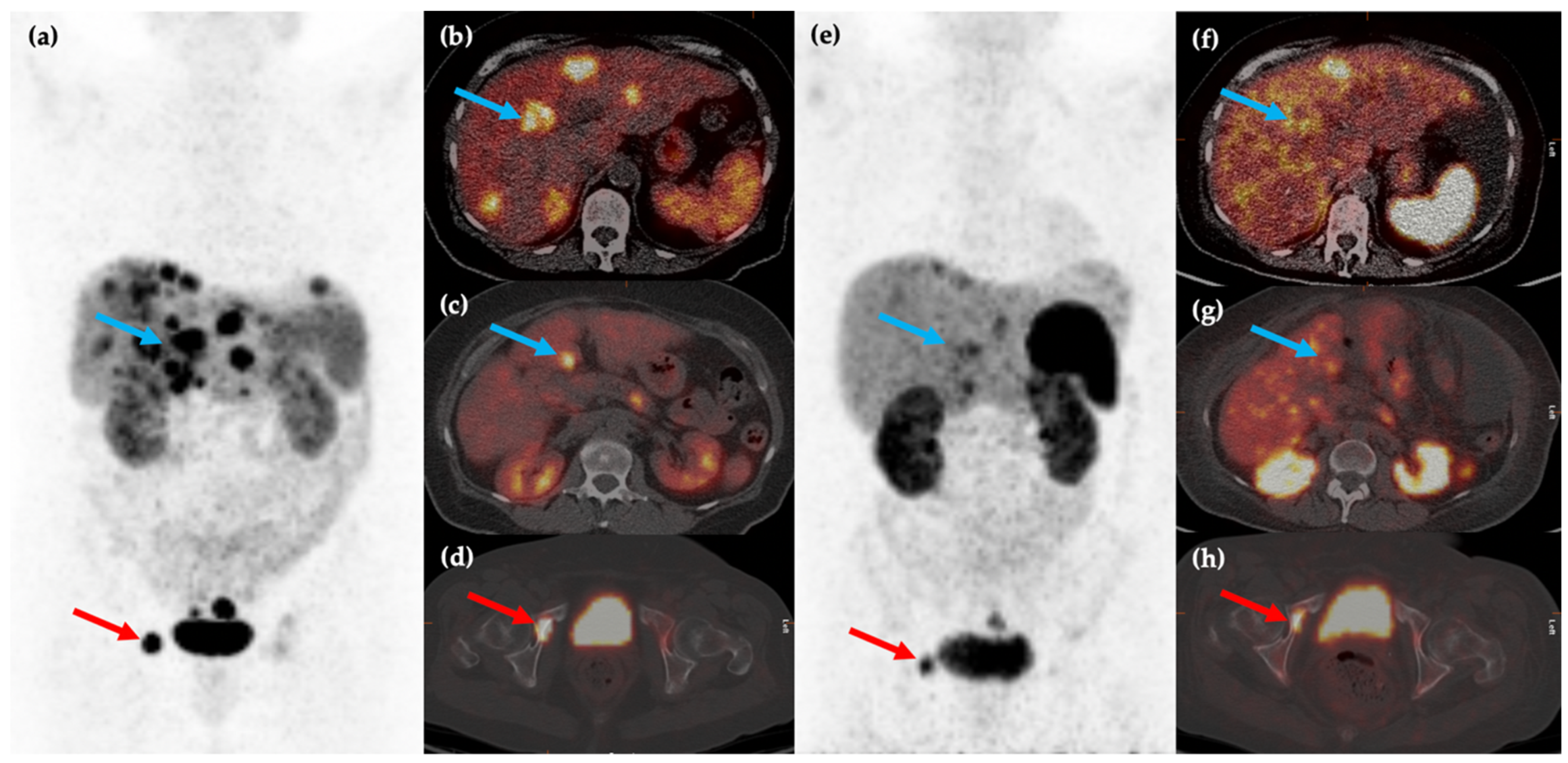 Cancers 14 00761 g003