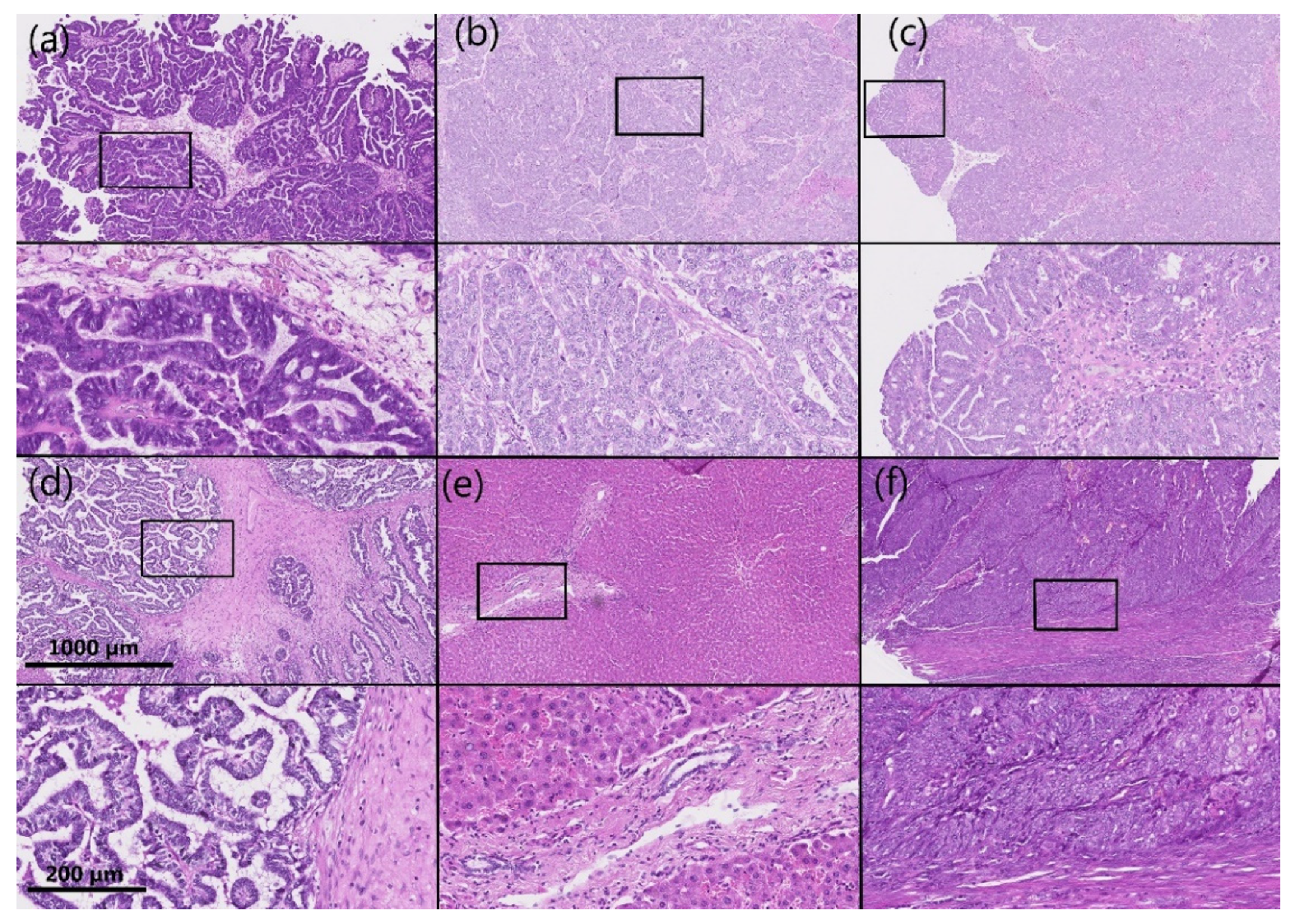 Cancers 14 00809 g005