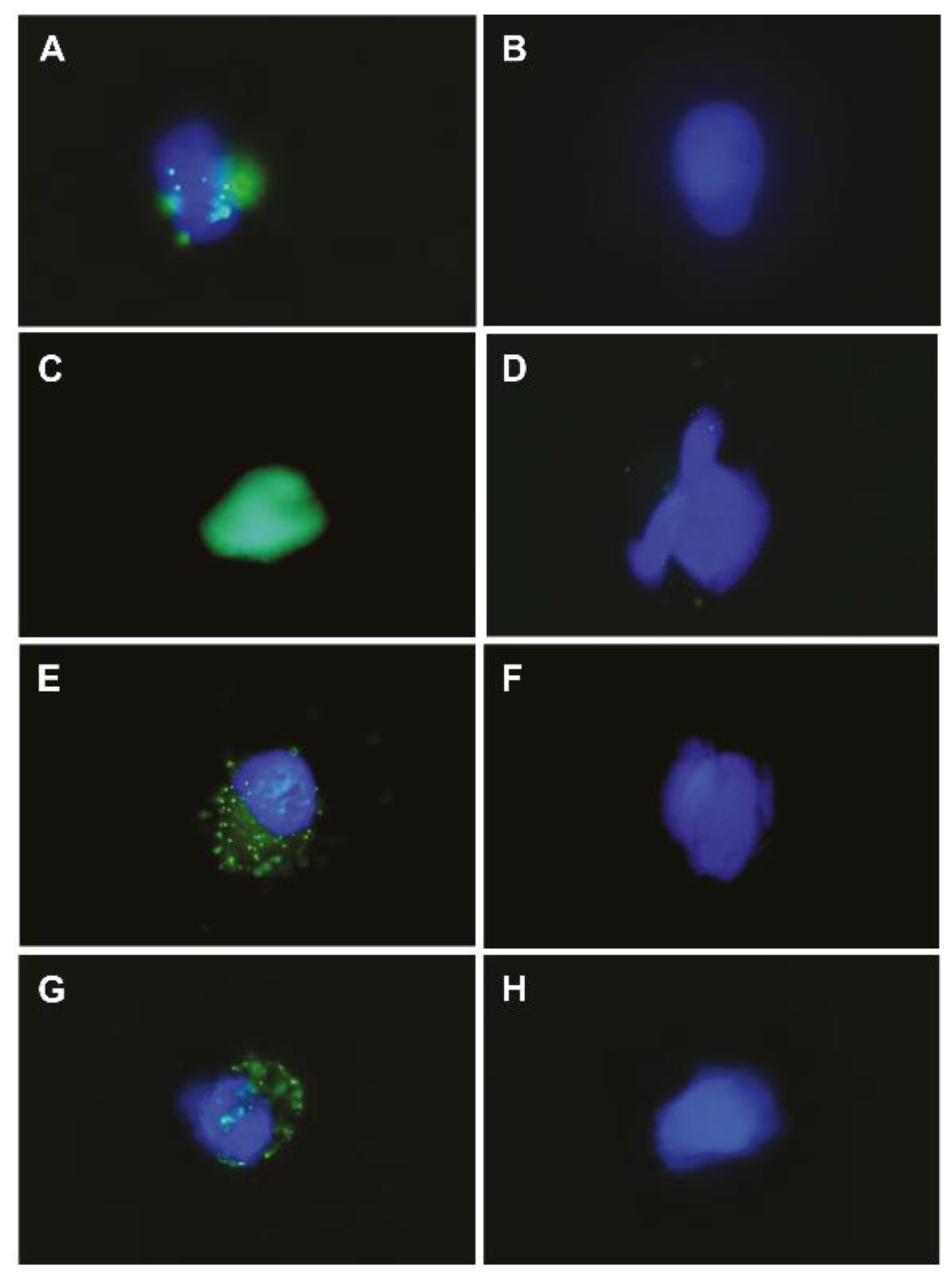 Cancers 14 00814 g006
