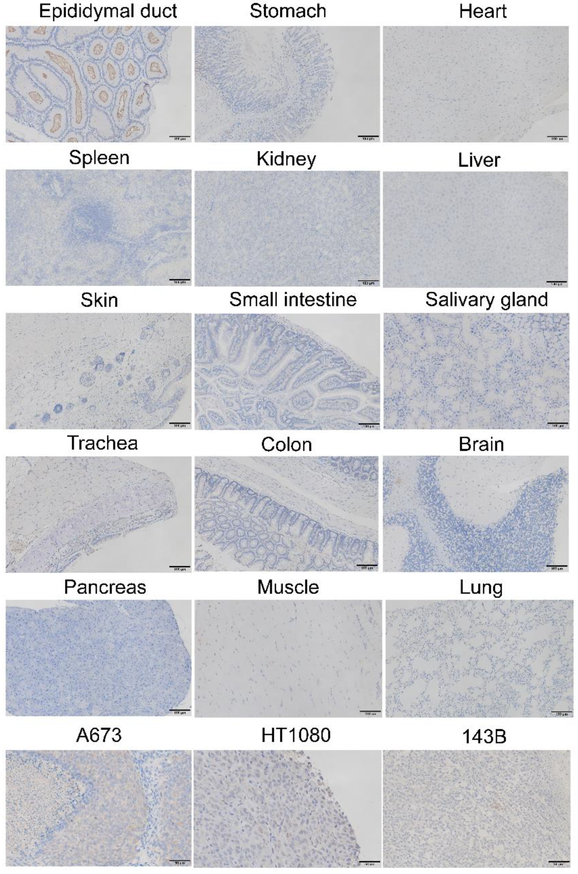 Cancers 14 00814 g008