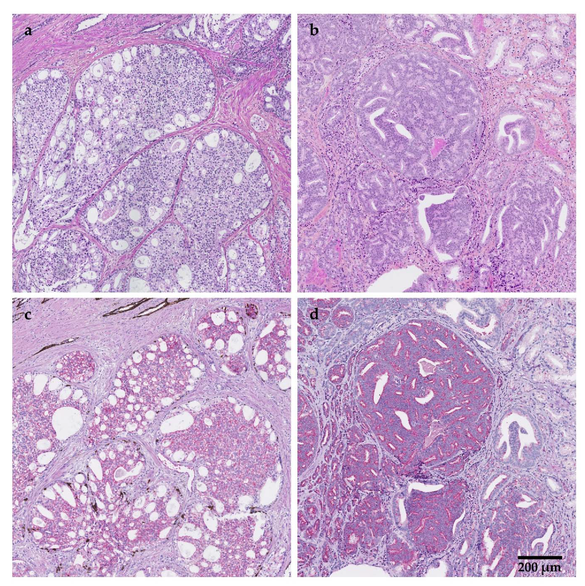 Cancers 14 00820 g001 Cancers 14 00820 g001