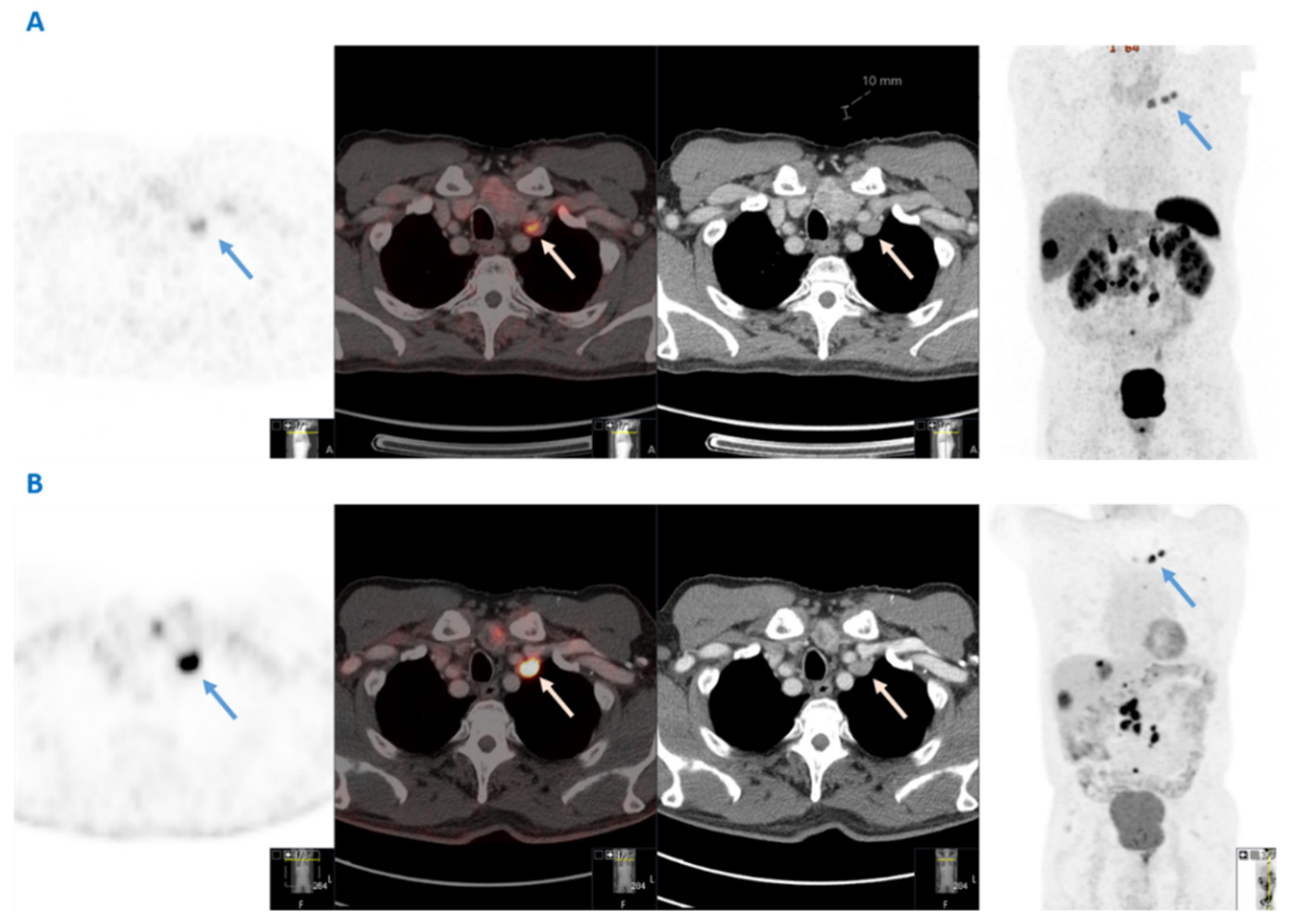 Cancers 14 00913 g001
