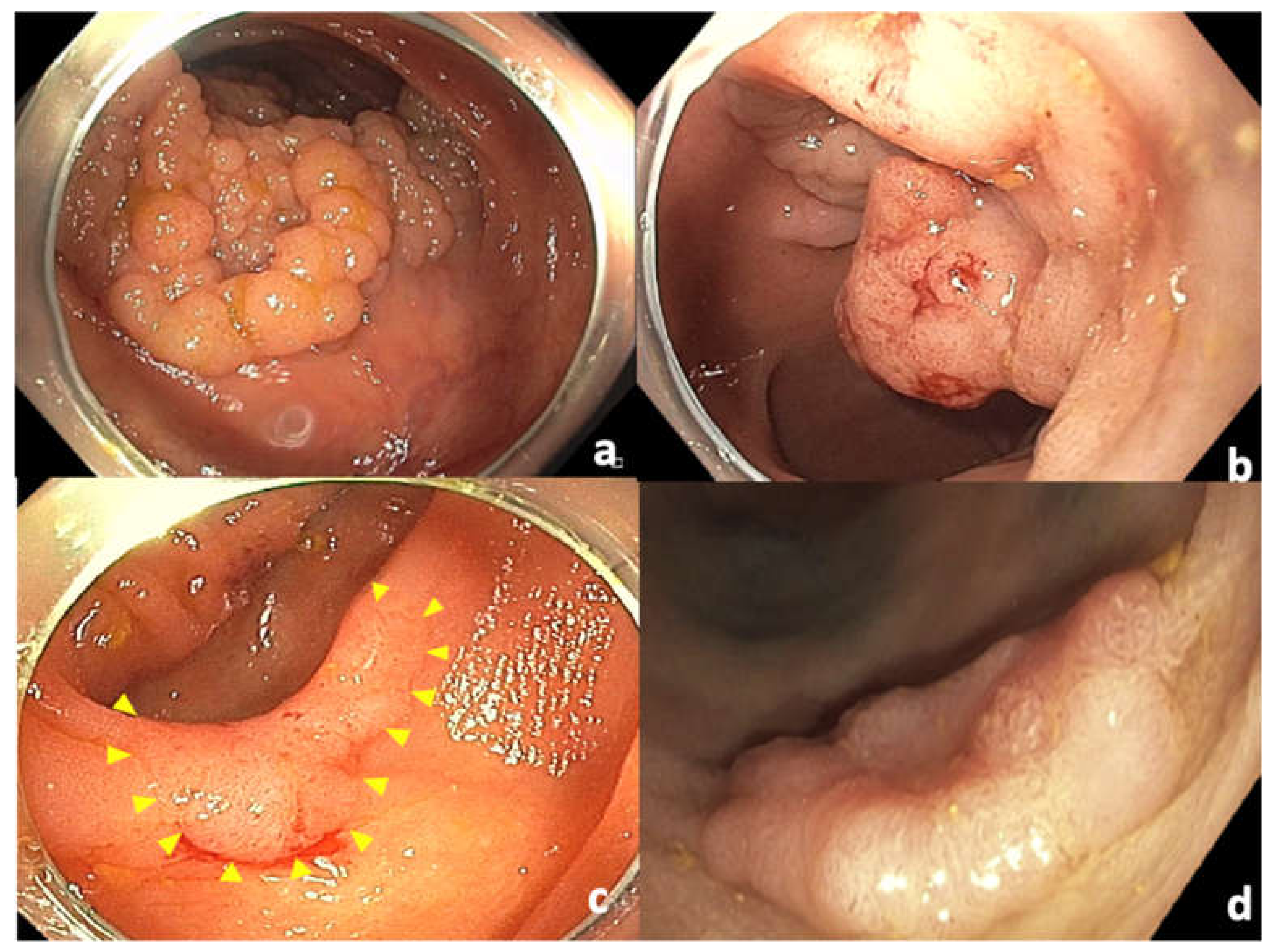 Cancers 14 00948 g003