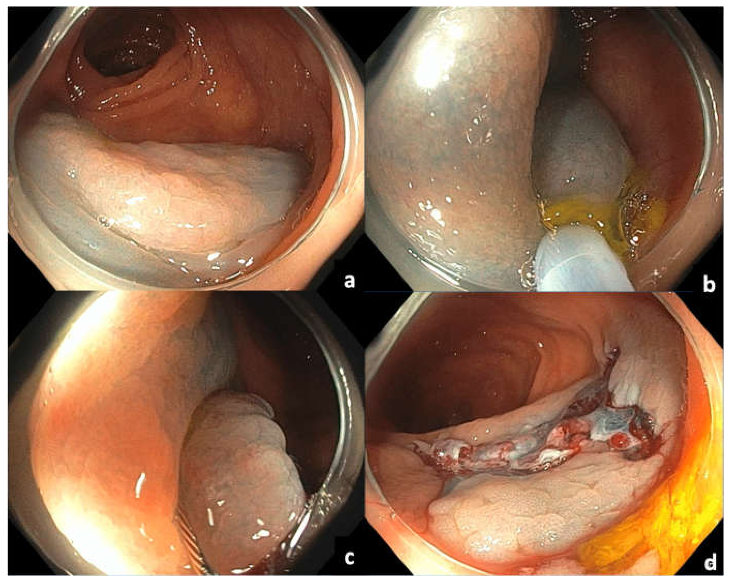 Cancers 14 00948 g004