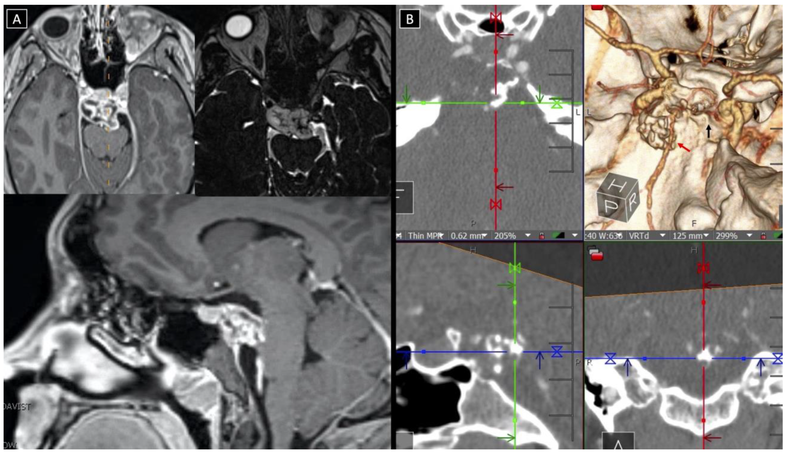 Cancers 14 00966 g002