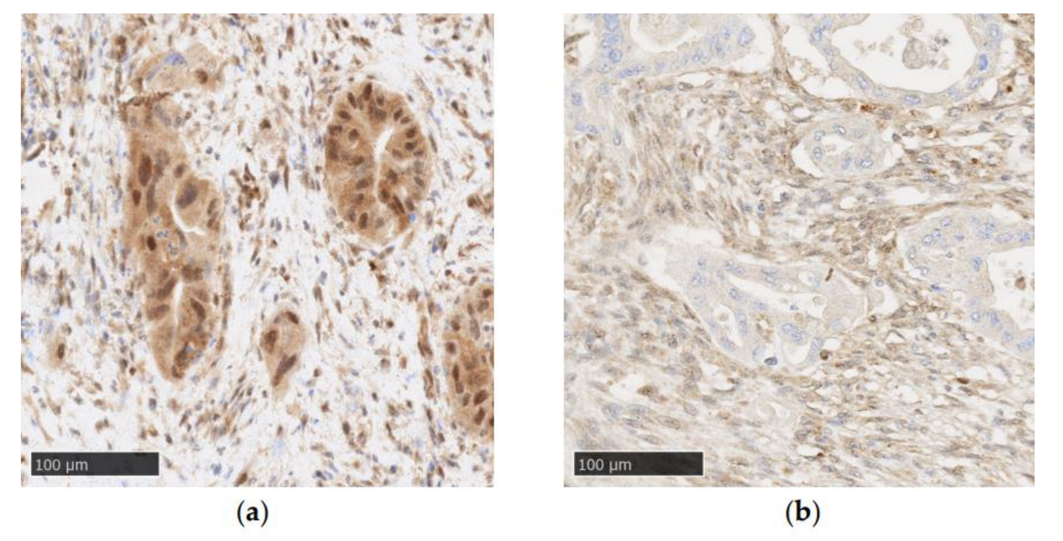 Cancers 14 00973 g002