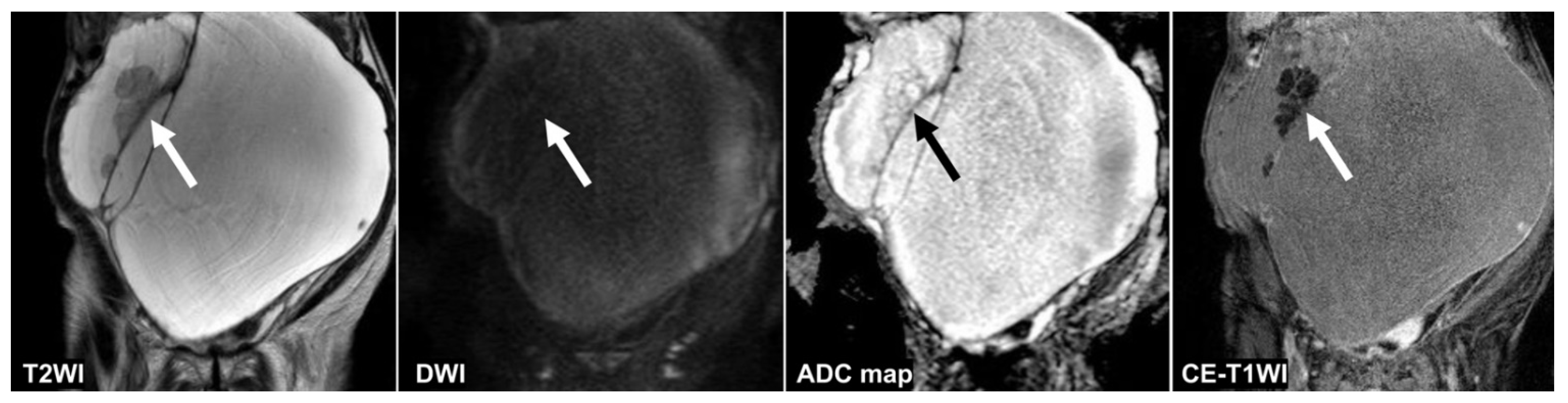 Cancers 14 00987 g005