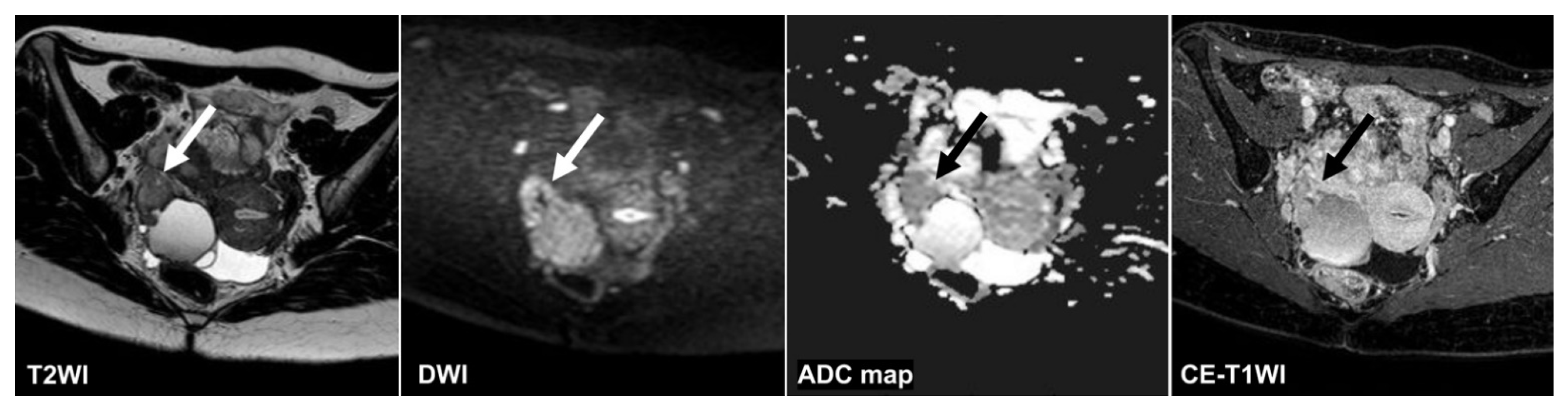 Cancers 14 00987 g006