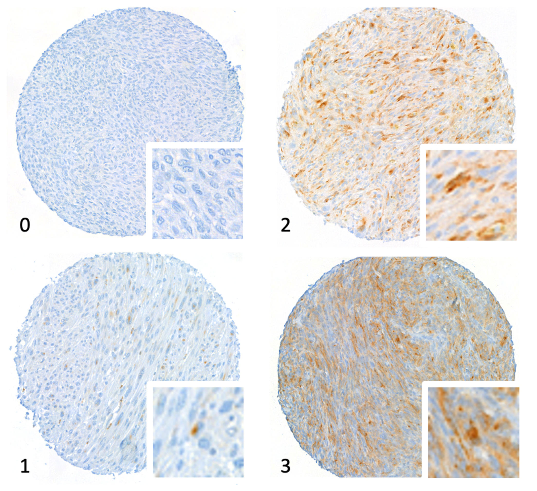 Cancers 14 01006 g001