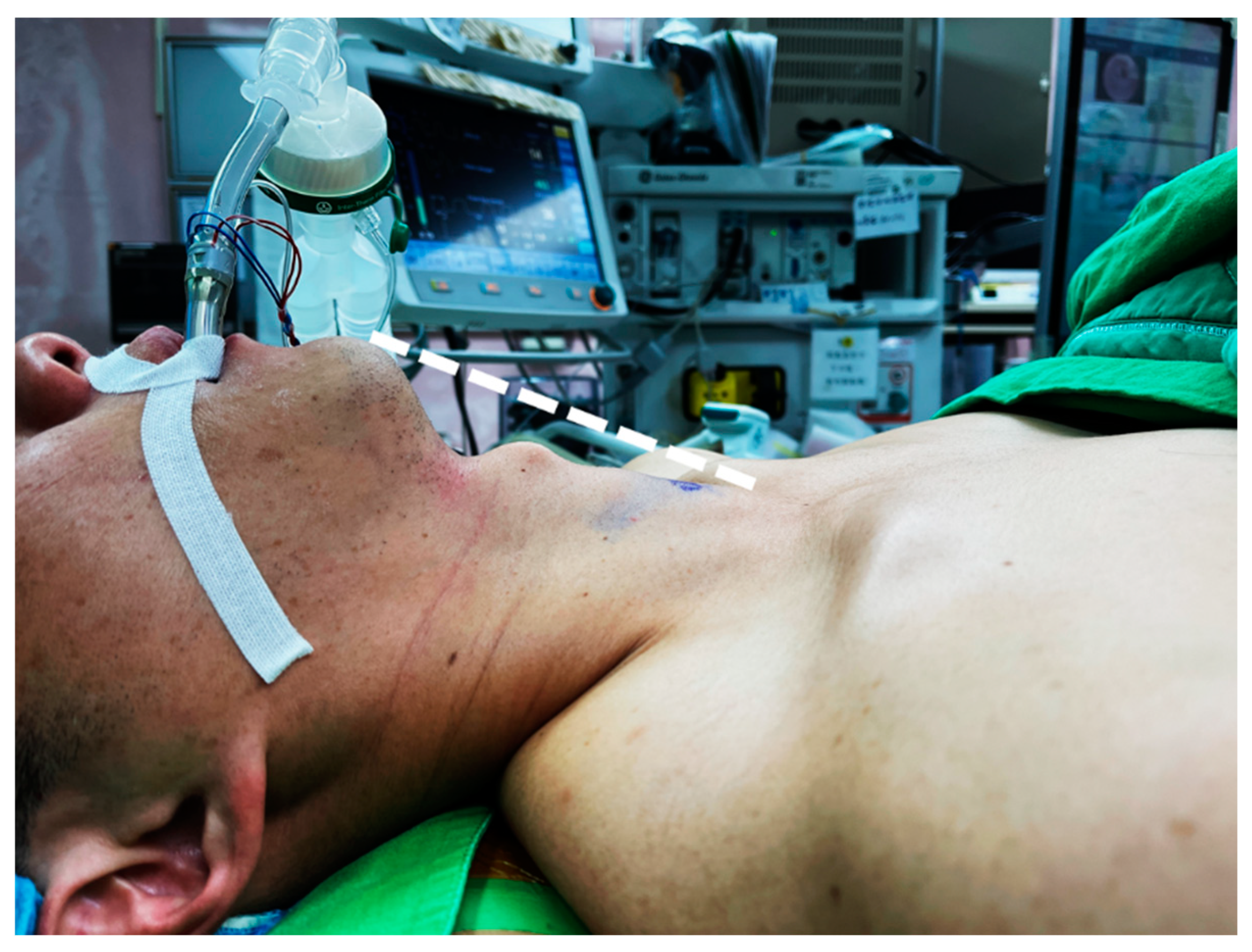 Cancers 14 01031 g001