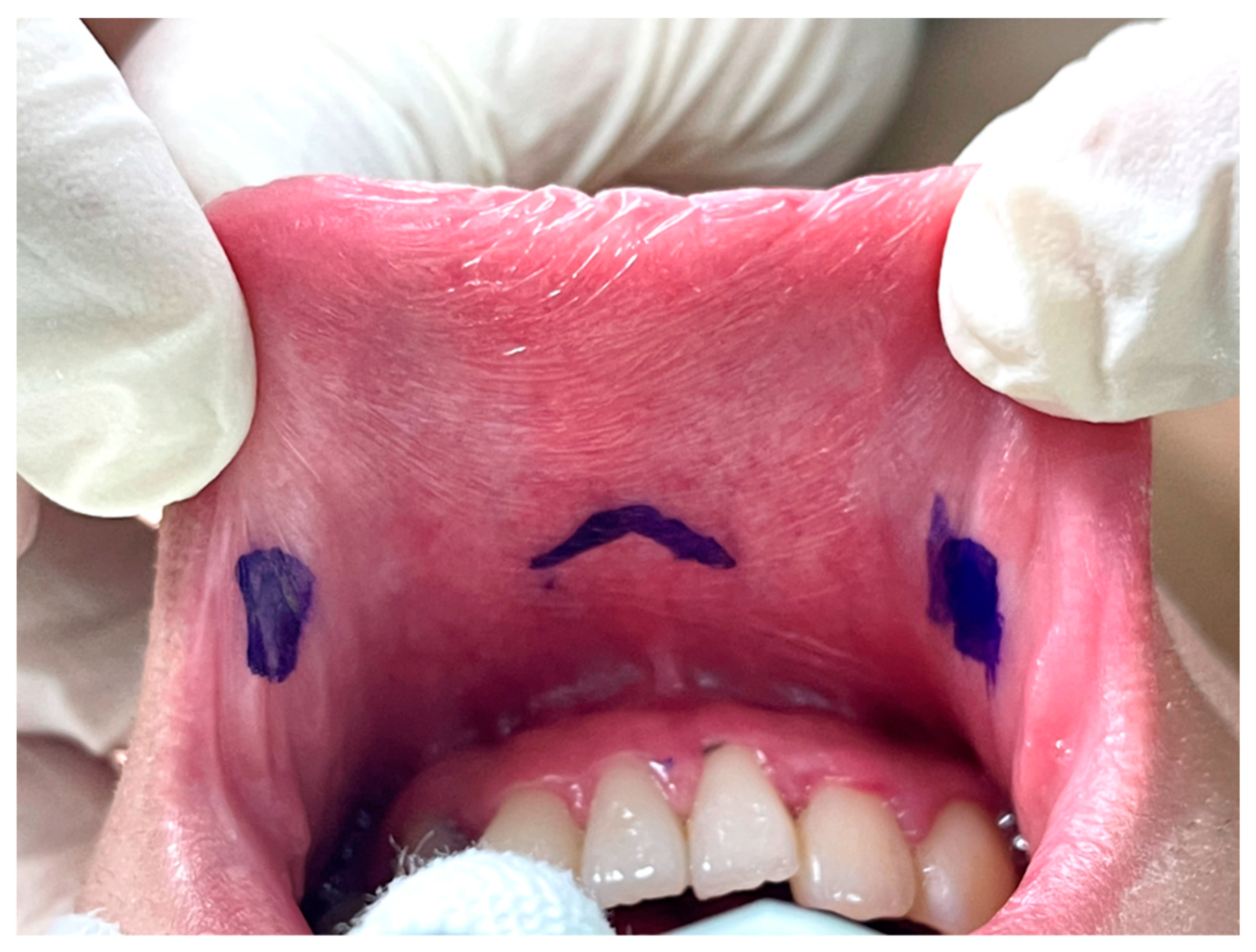 Cancers 14 01031 g002