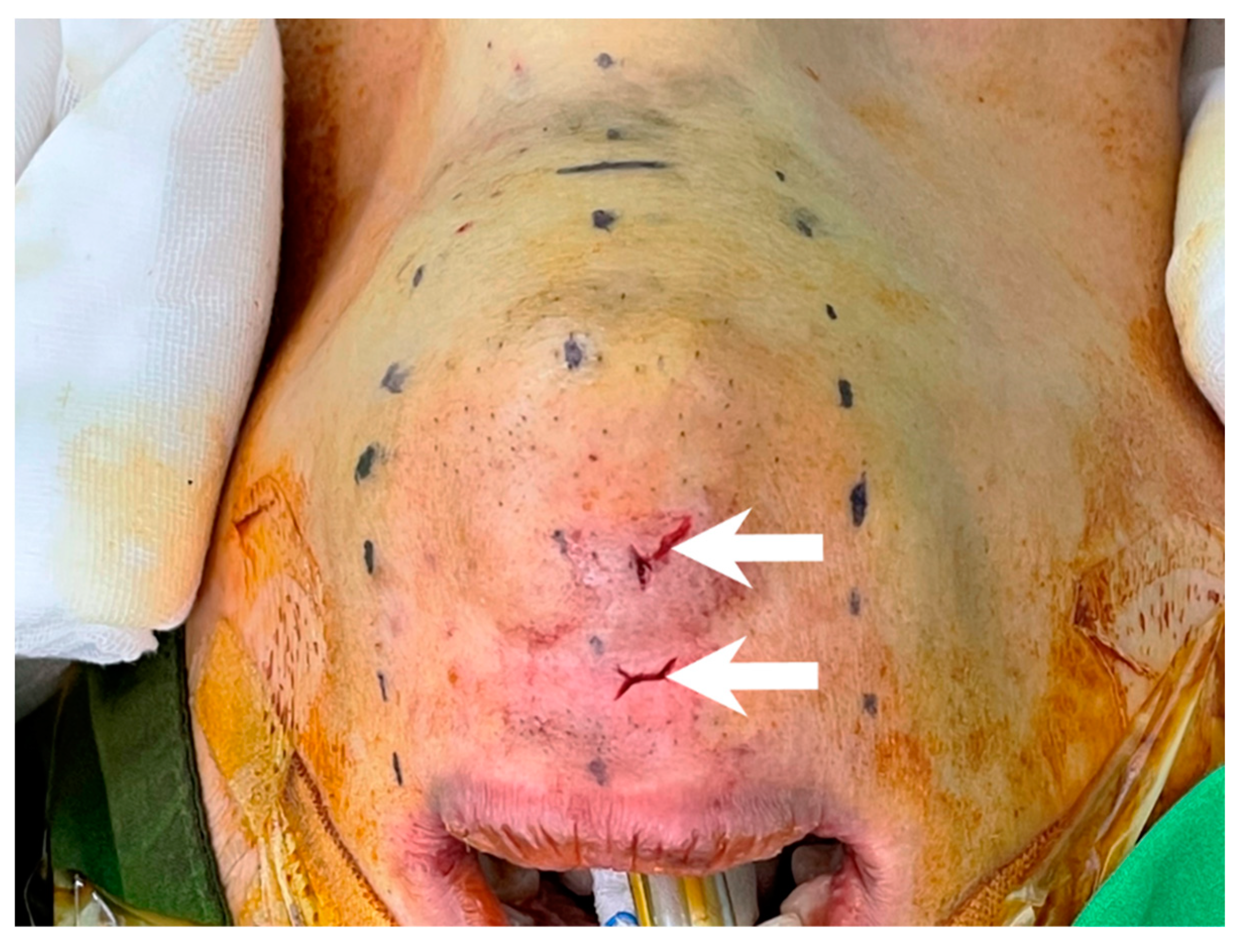 Cancers 14 01031 g003